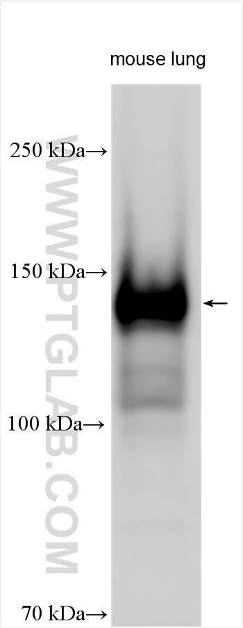 WB analysis using 55367-1-AP