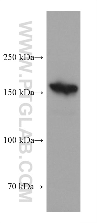 WB analysis of MKN-45 using 60413-1-Ig