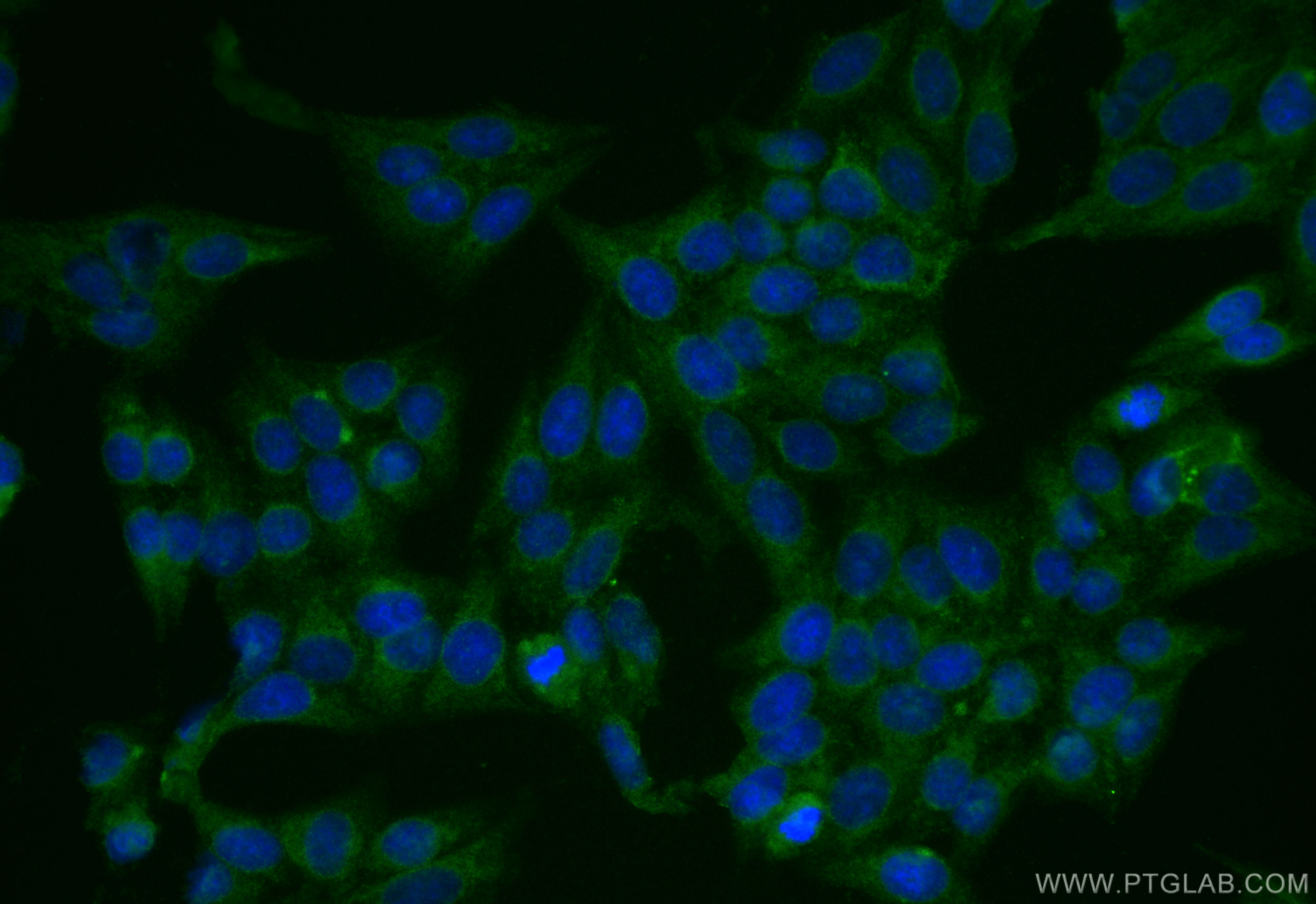 IF Staining of HepG2 using 17415-1-AP