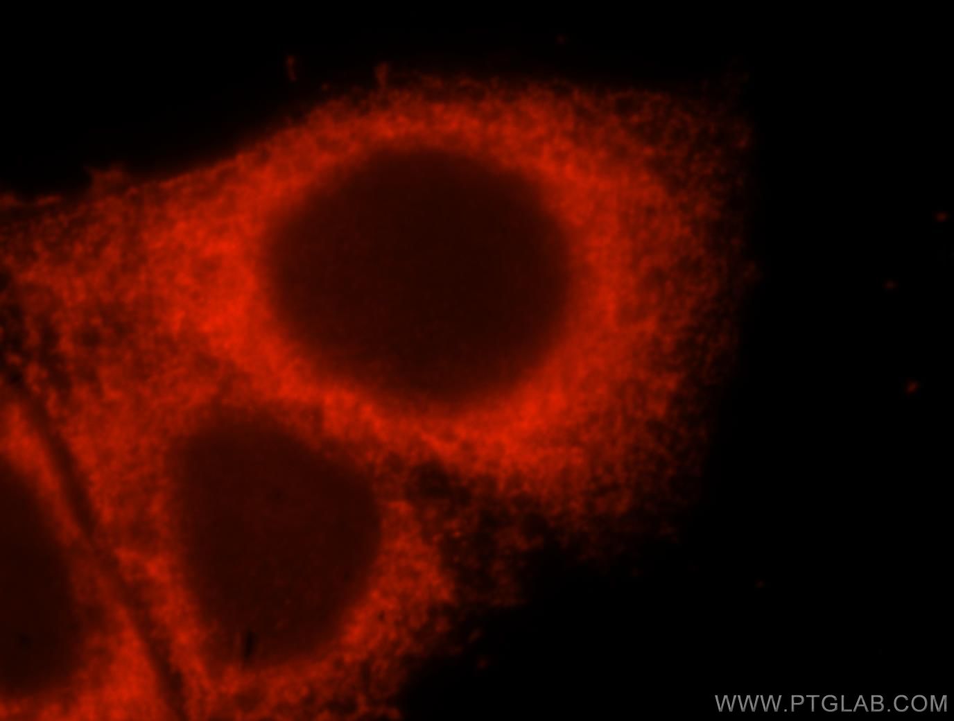 IF Staining of HepG2 using 17415-1-AP