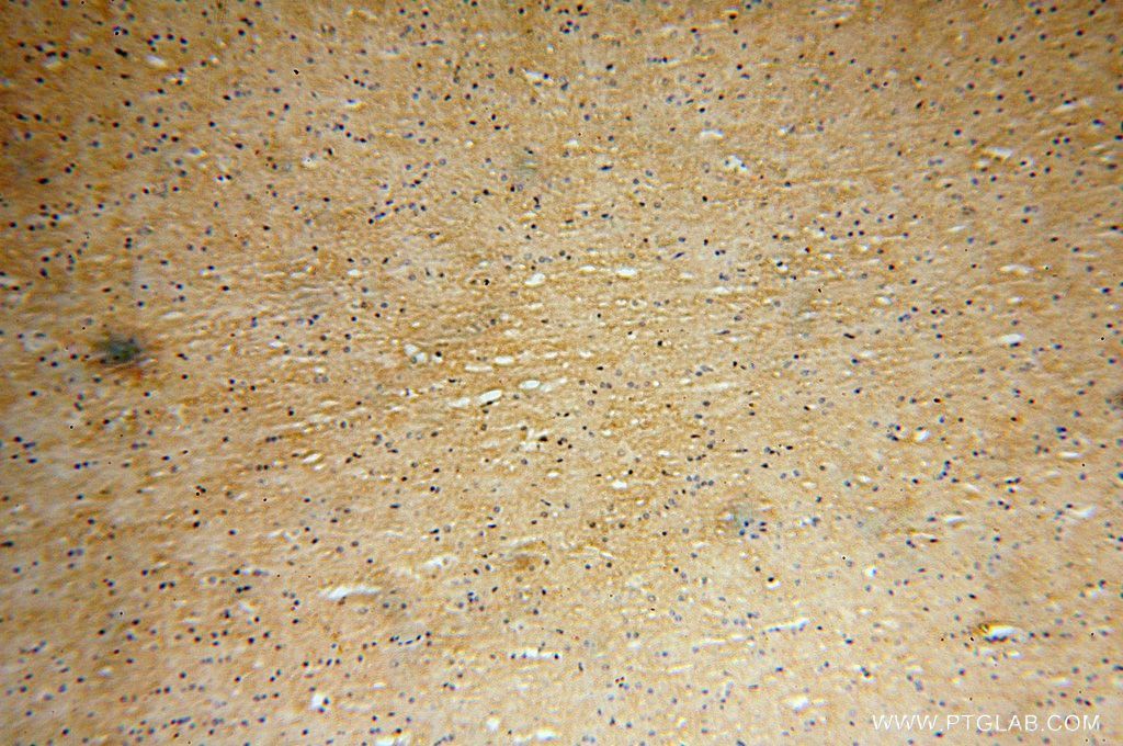 IHC staining of human brain using 17415-1-AP