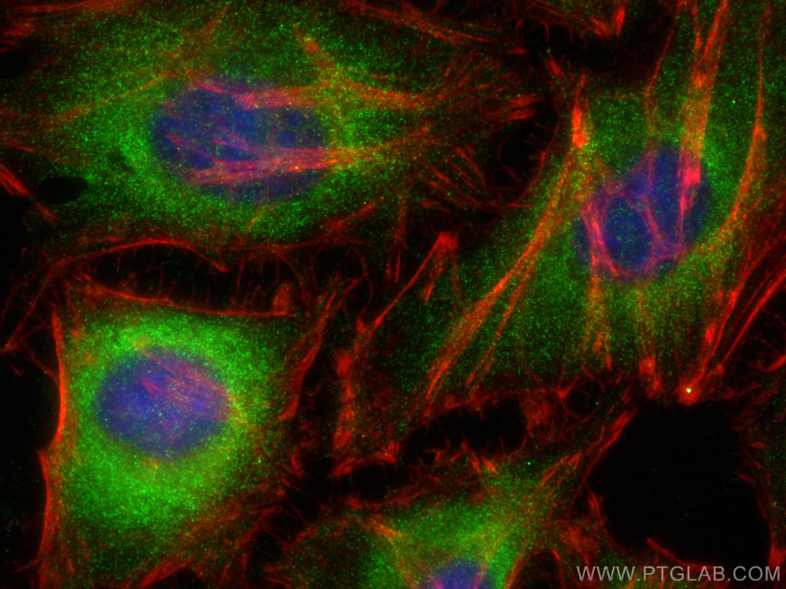 IF Staining of HeLa using 17313-1-AP