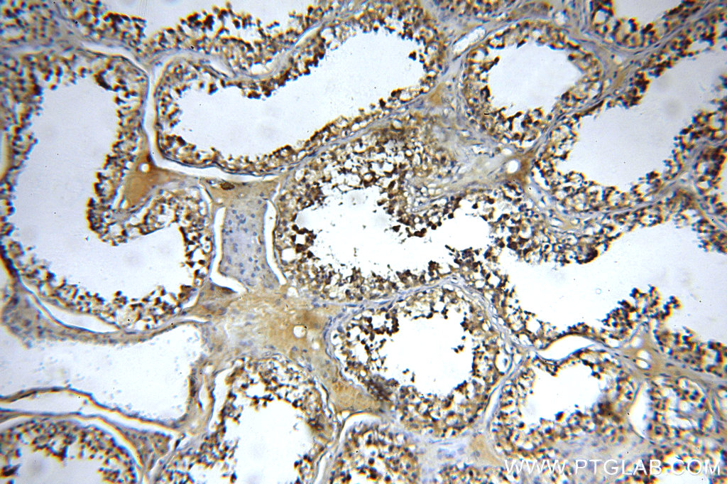 IHC staining of human testis using 20138-1-AP