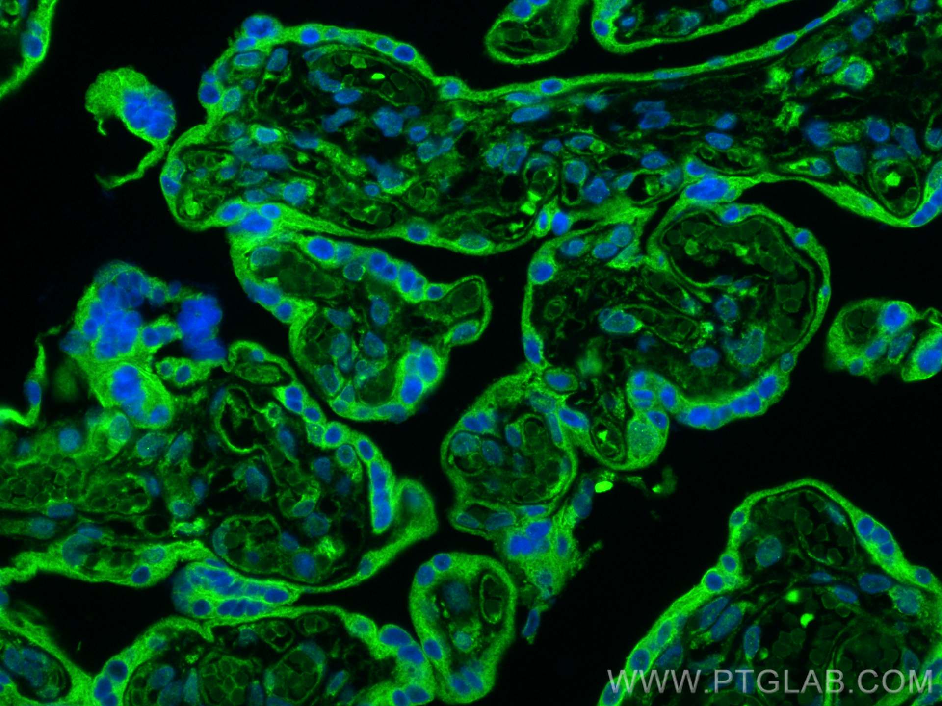 IF Staining of human placenta using 11690-1-AP