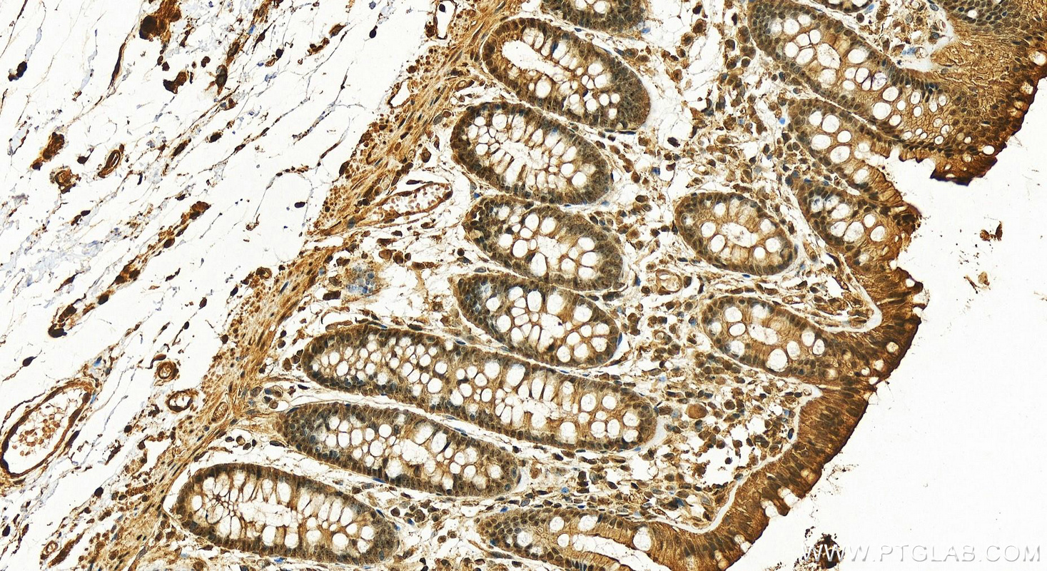 IHC staining of human colon using 25292-1-AP