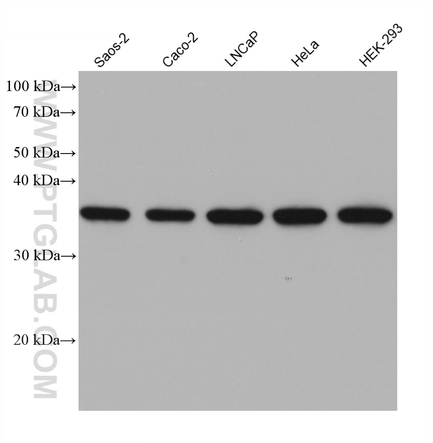 WB analysis using 68456-1-Ig (same clone as 68456-1-PBS)