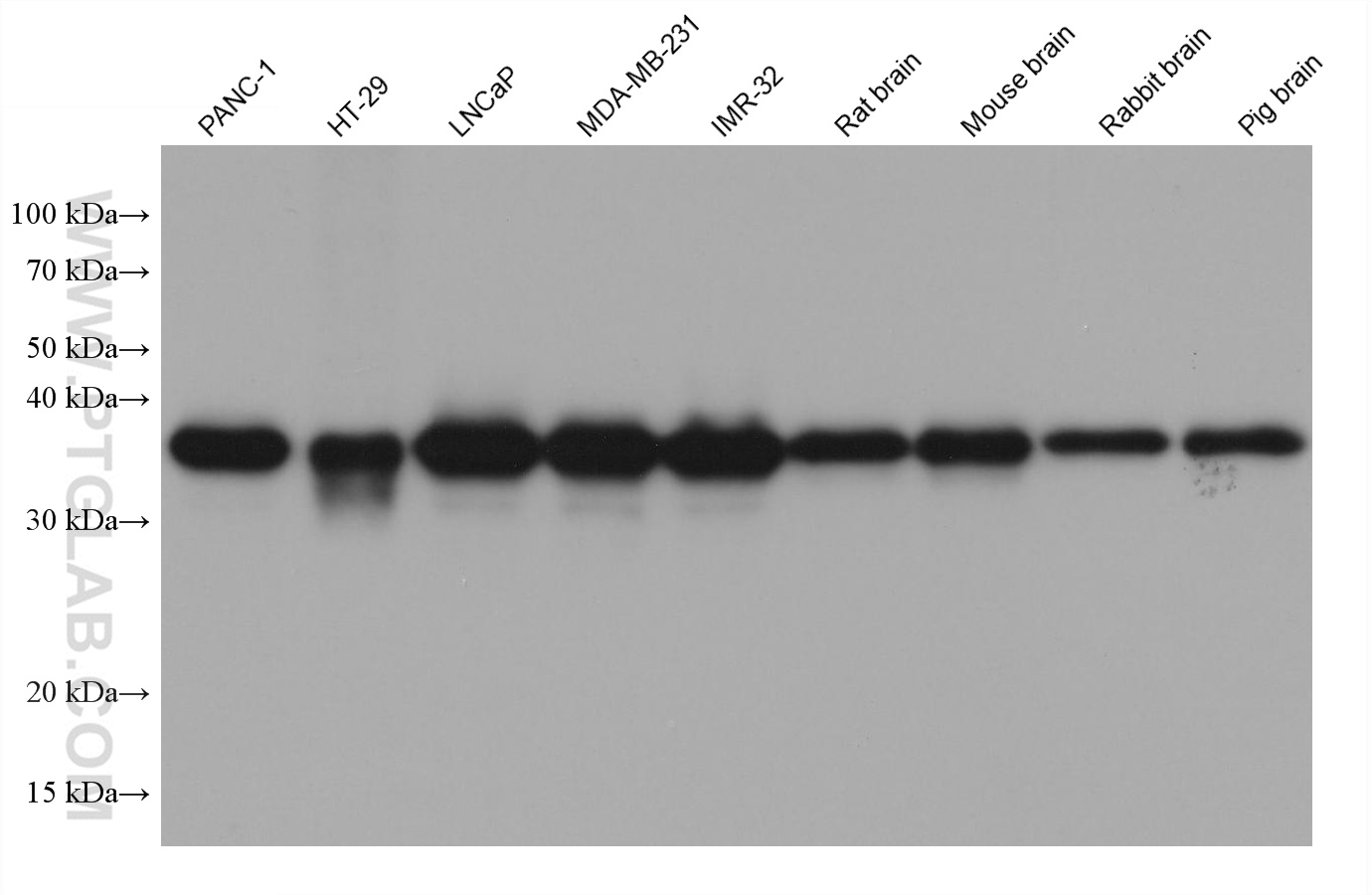 WB analysis using 68456-1-Ig (same clone as 68456-1-PBS)