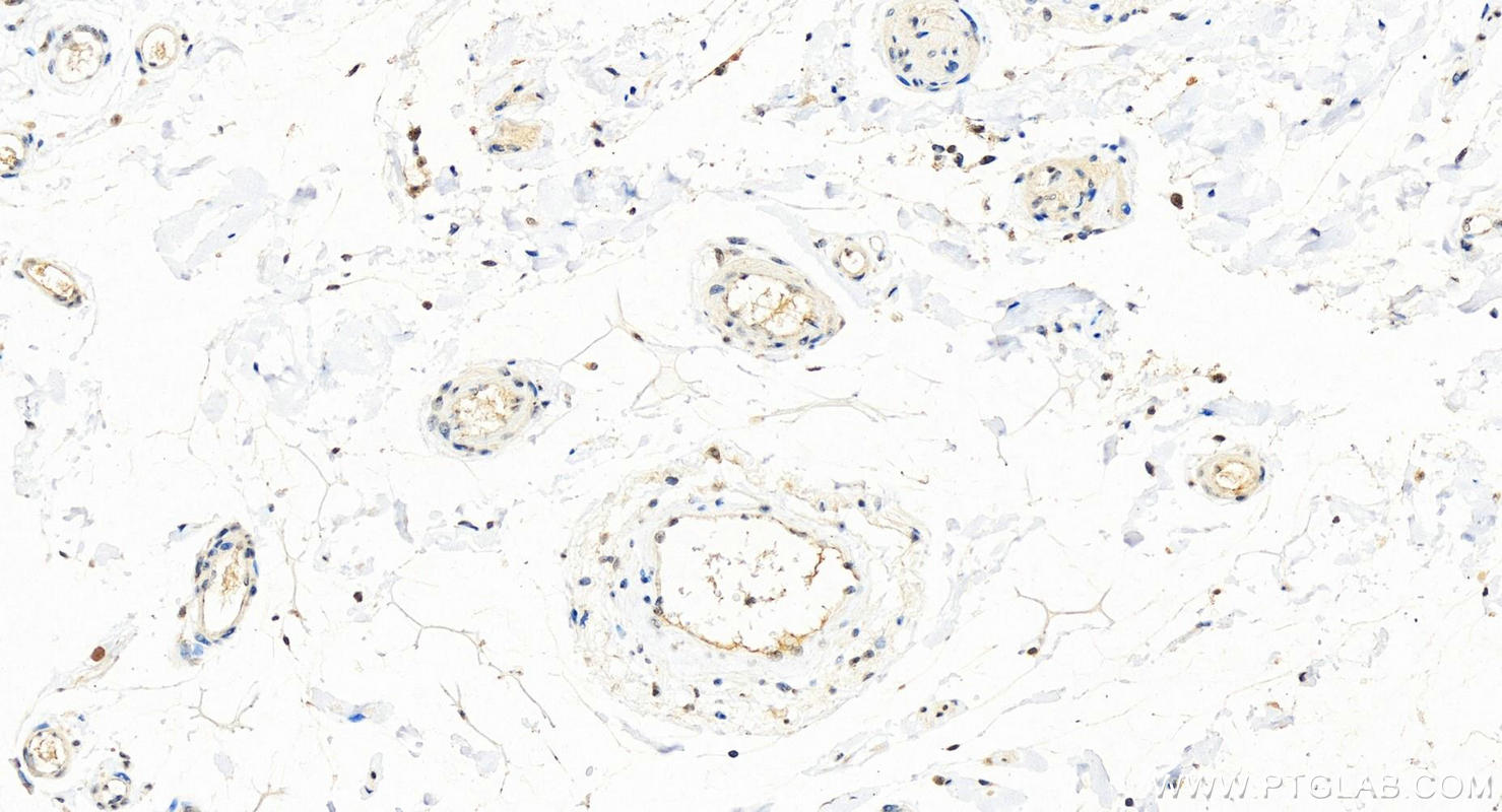 IHC staining of human colon using 11979-1-AP