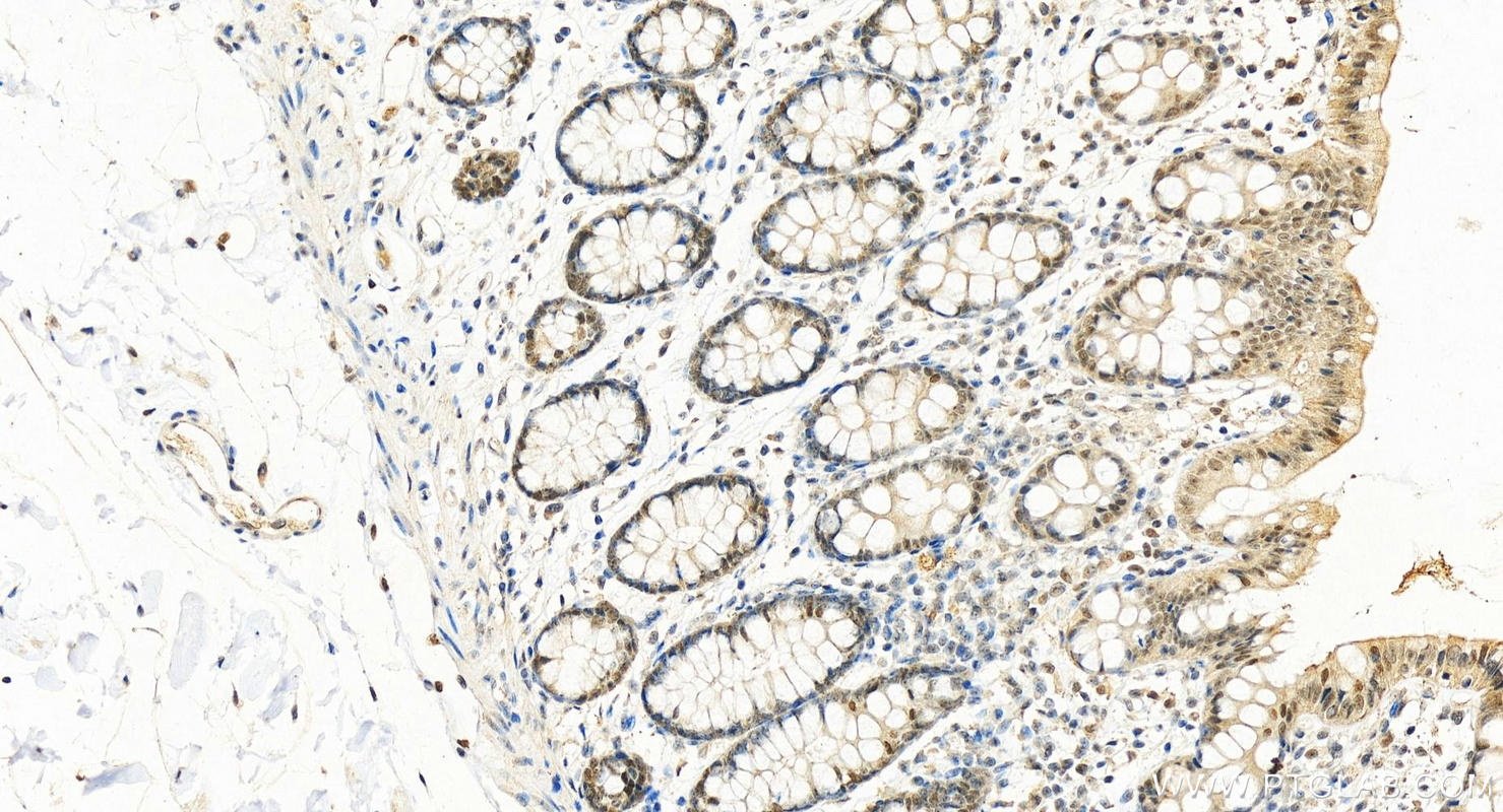 IHC staining of human colon using 11979-1-AP