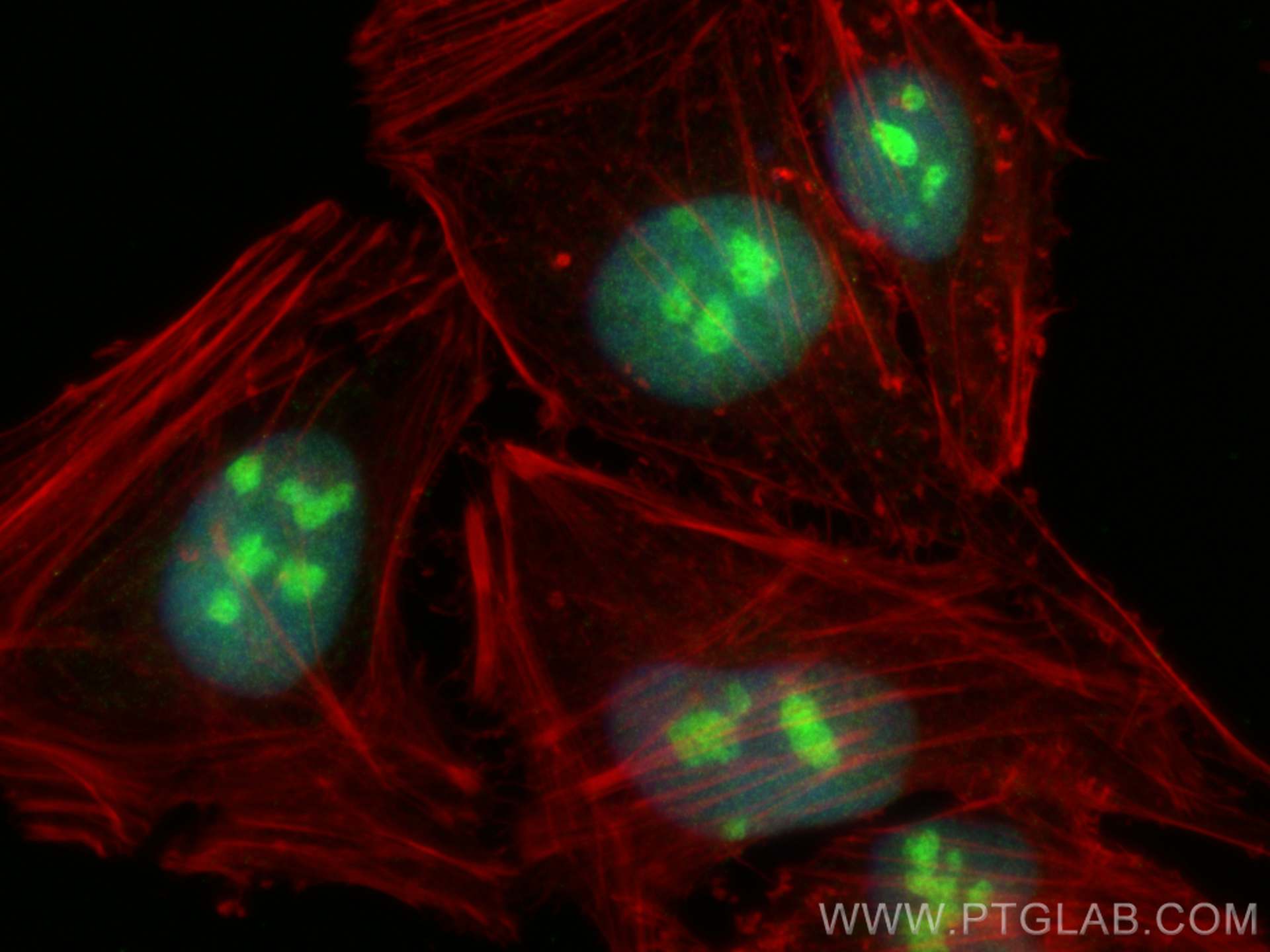 IF Staining of HeLa using 67636-1-Ig (same clone as 67636-1-PBS)