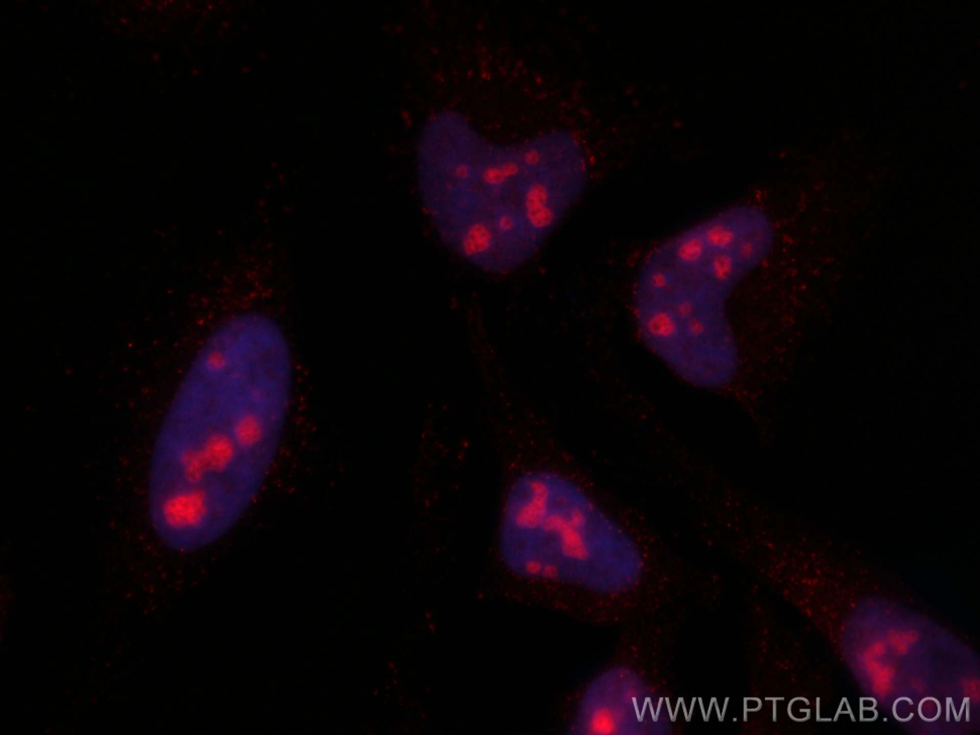 IF Staining of HeLa using CL594-67636