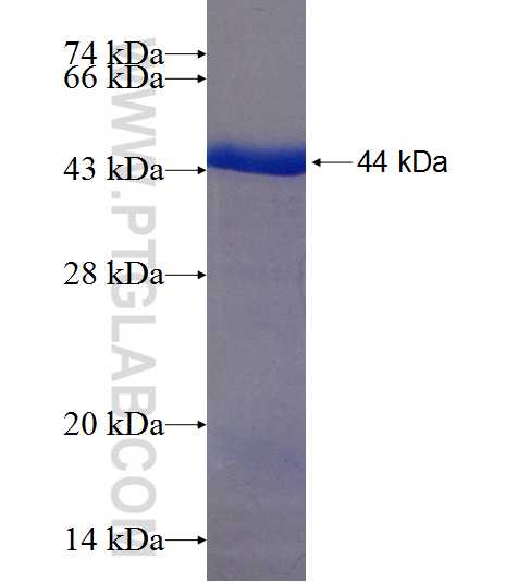 EXOSC9 fusion protein Ag19783 SDS-PAGE