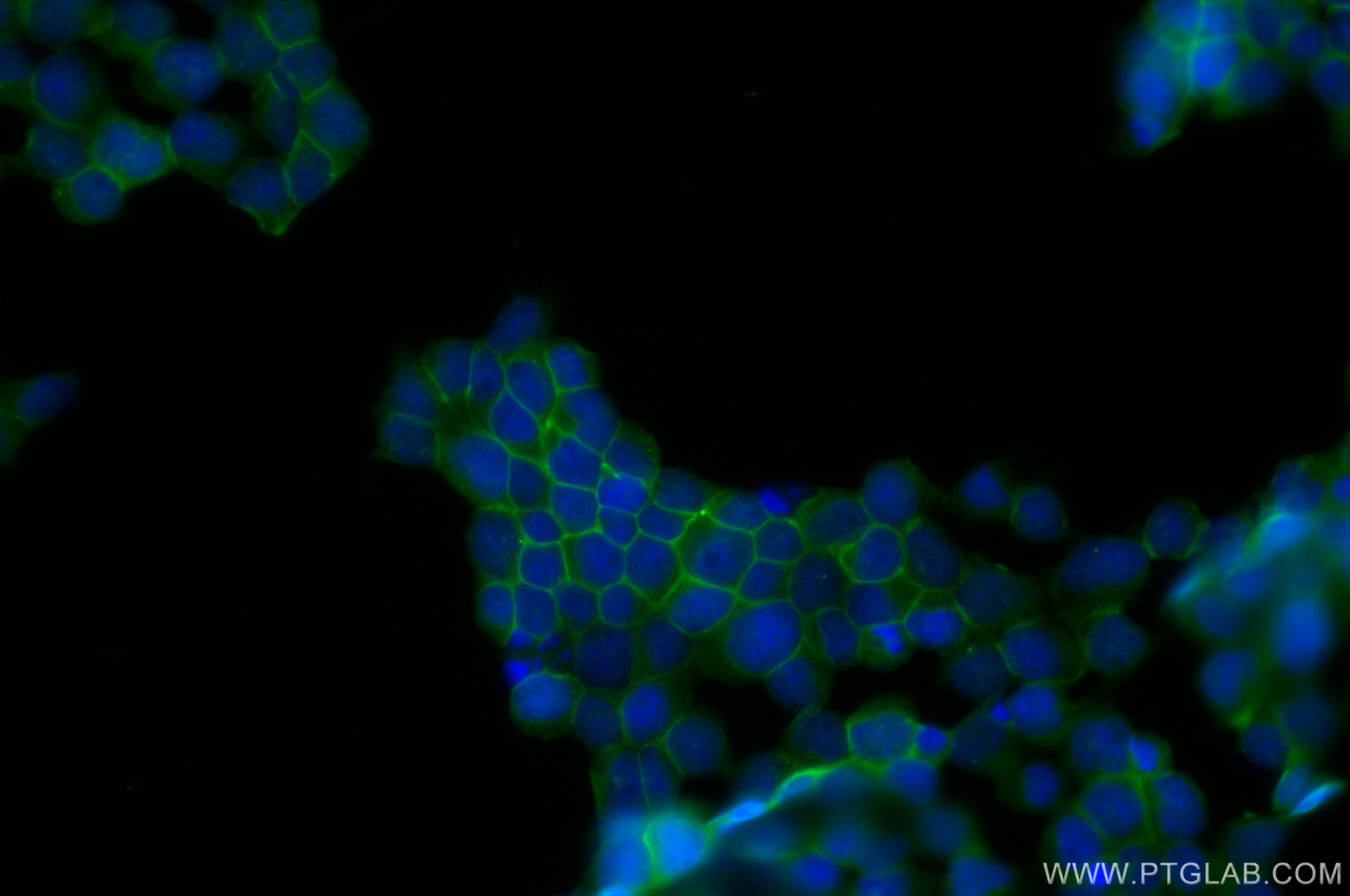 IF Staining of Jurkat using 11348-1-AP