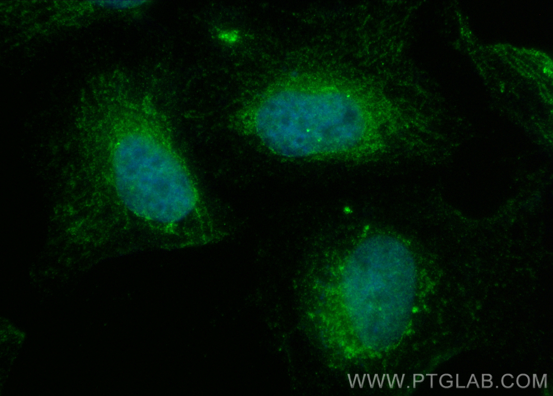 IF Staining of HeLa using CL488-22658