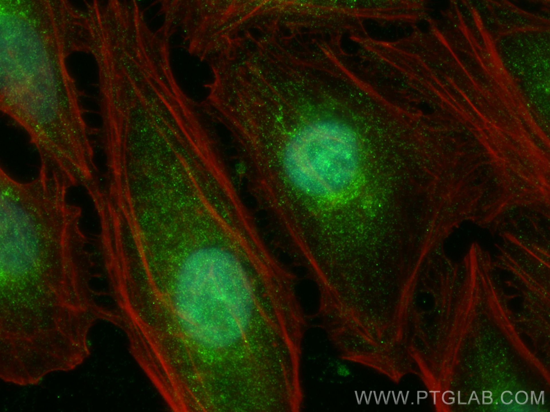 IF Staining of HeLa using 30607-1-AP