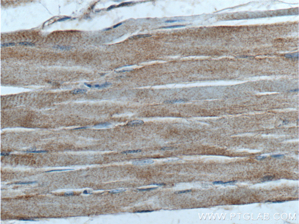 IHC staining of human skeletal muscle using 24691-1-AP