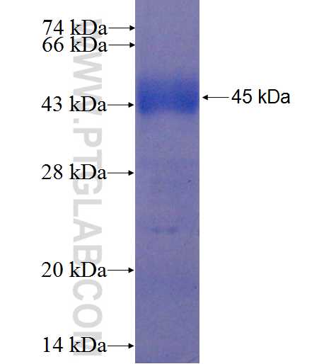 EYS fusion protein Ag22389 SDS-PAGE