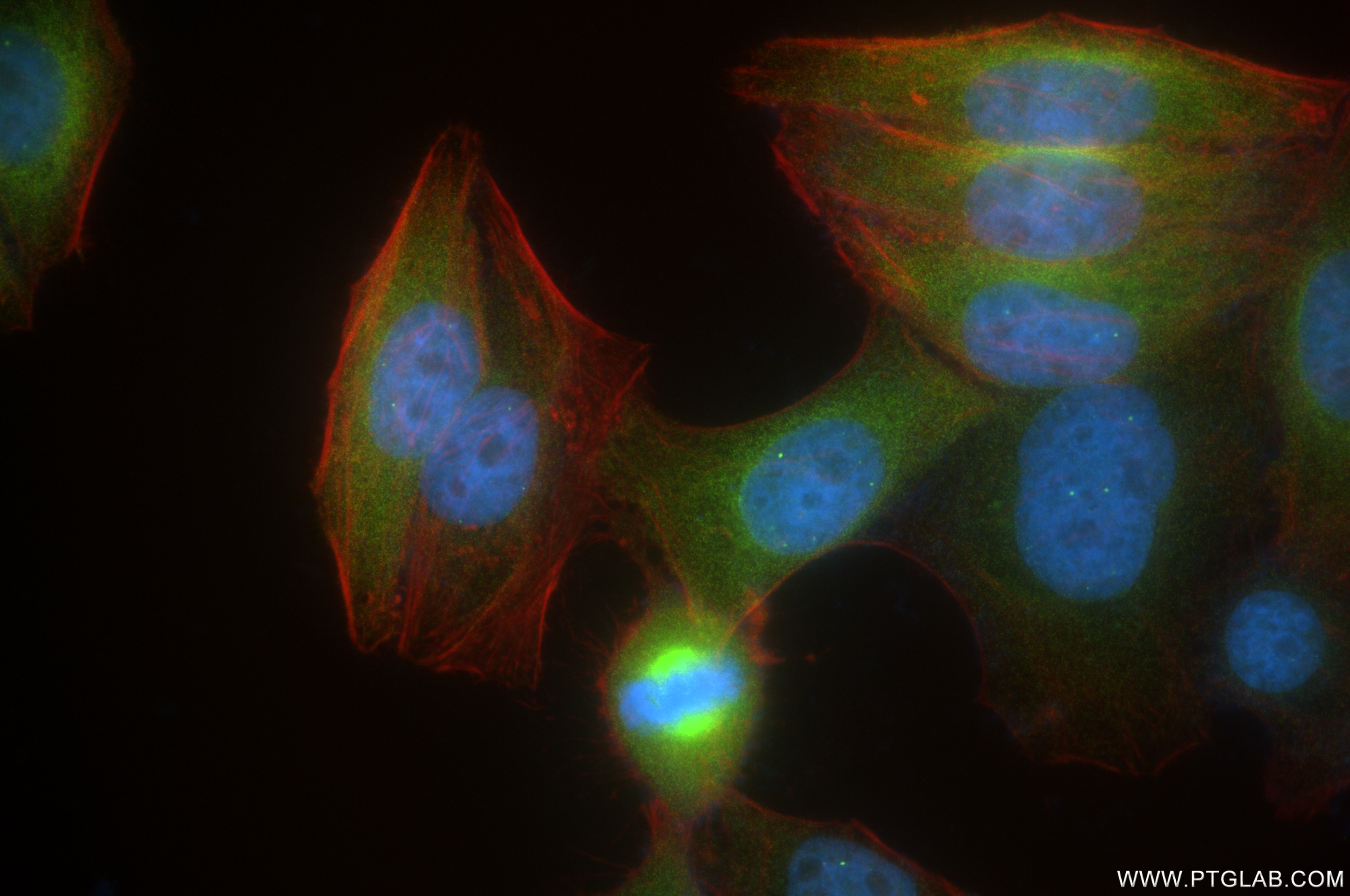 IF Staining of HepG2 using 84966-2-RR (same clone as 84966-2-PBS)