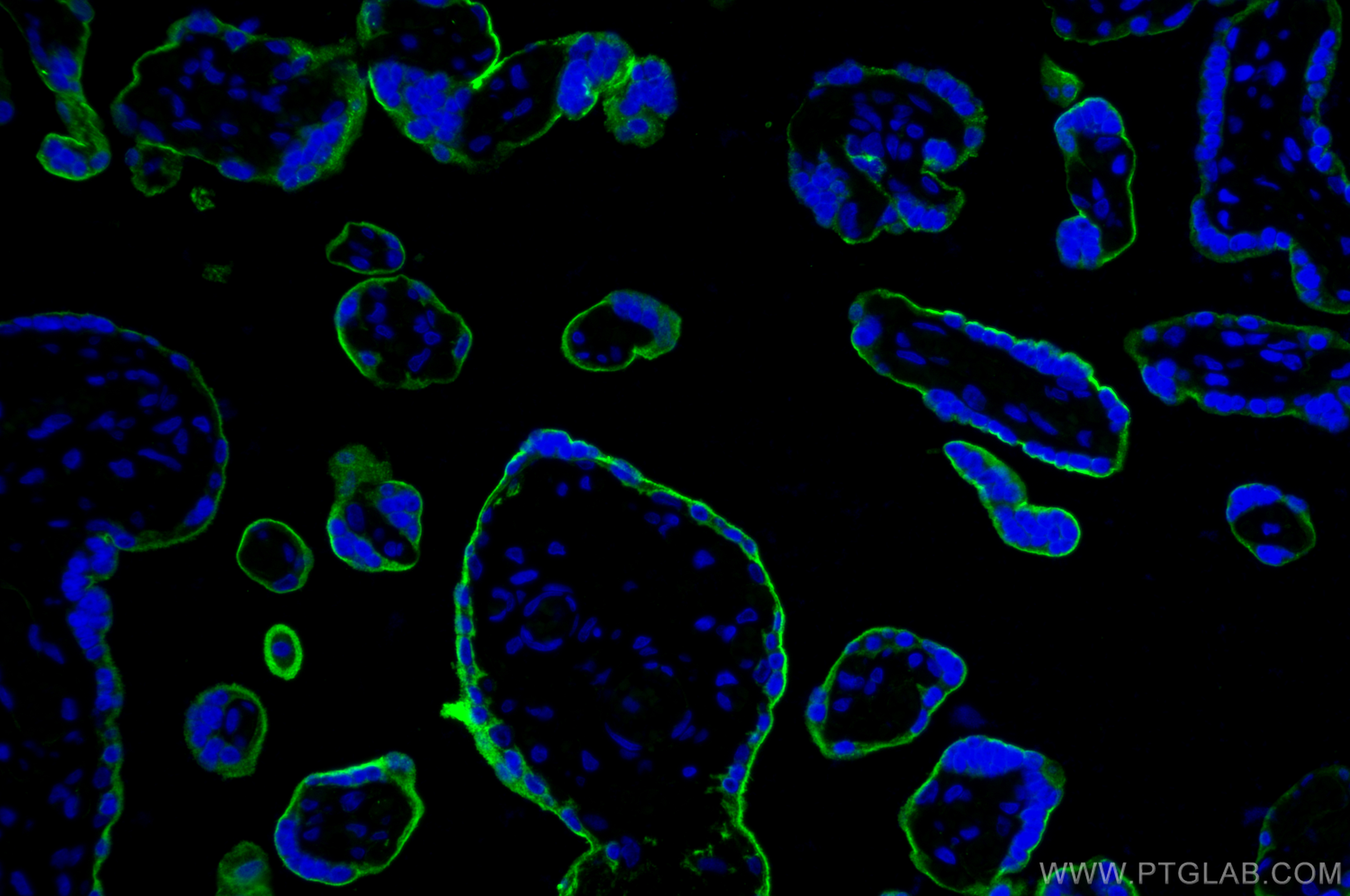 IF Staining of human placenta using 30730-1-AP