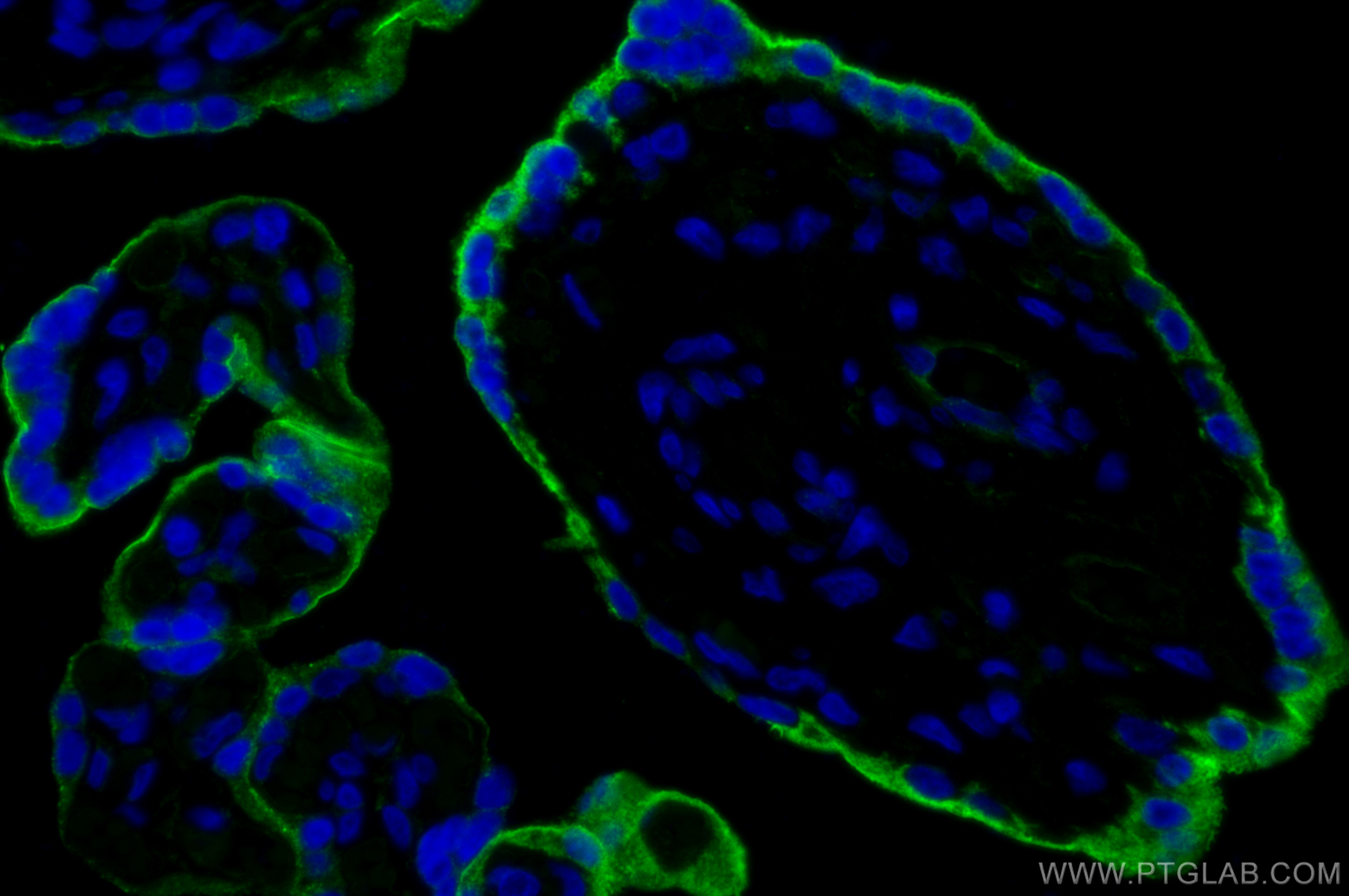 IF Staining of human placenta using 30730-1-AP