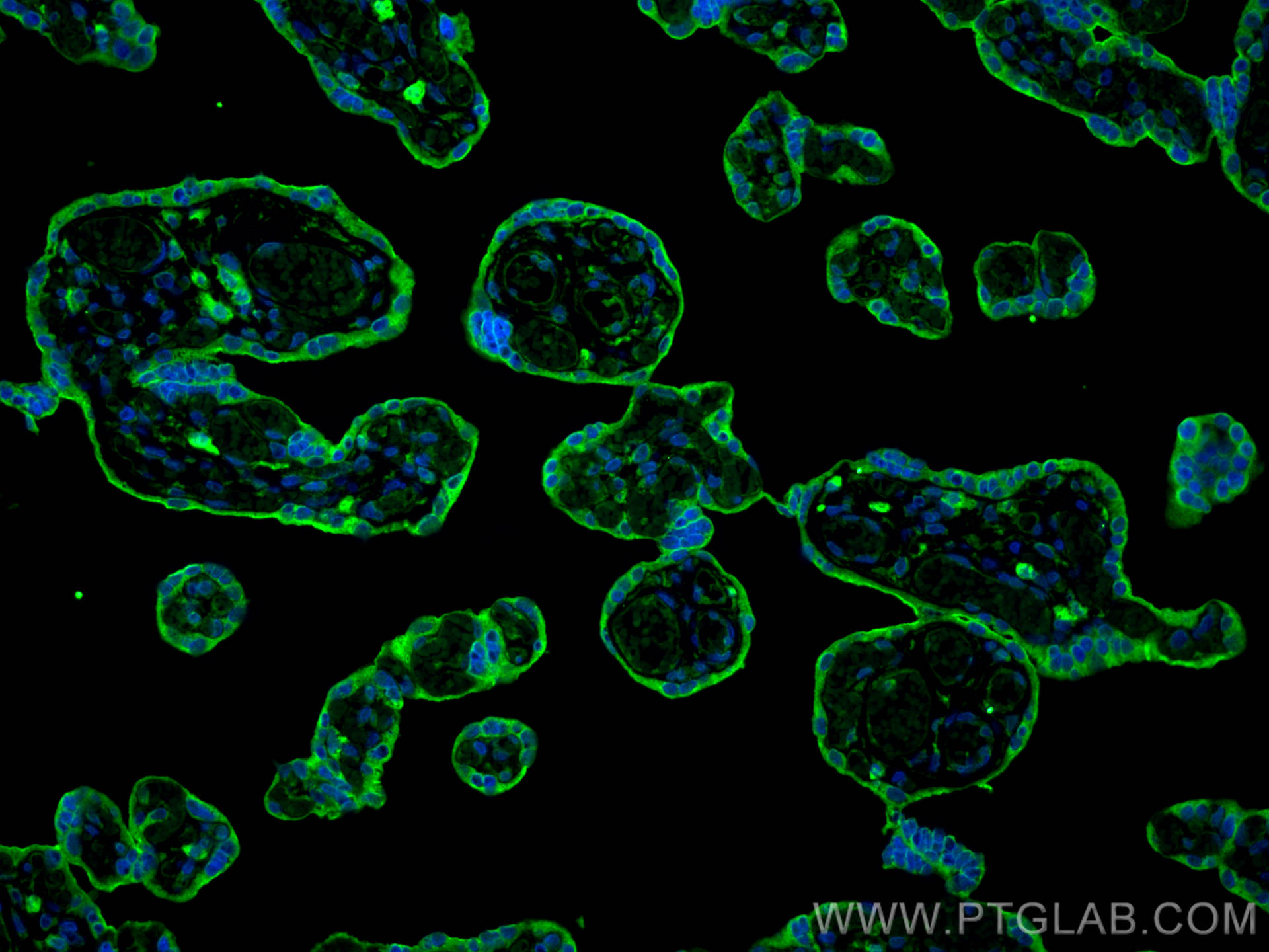 IF Staining of human placenta using 67075-1-Ig (same clone as 67075-1-PBS)