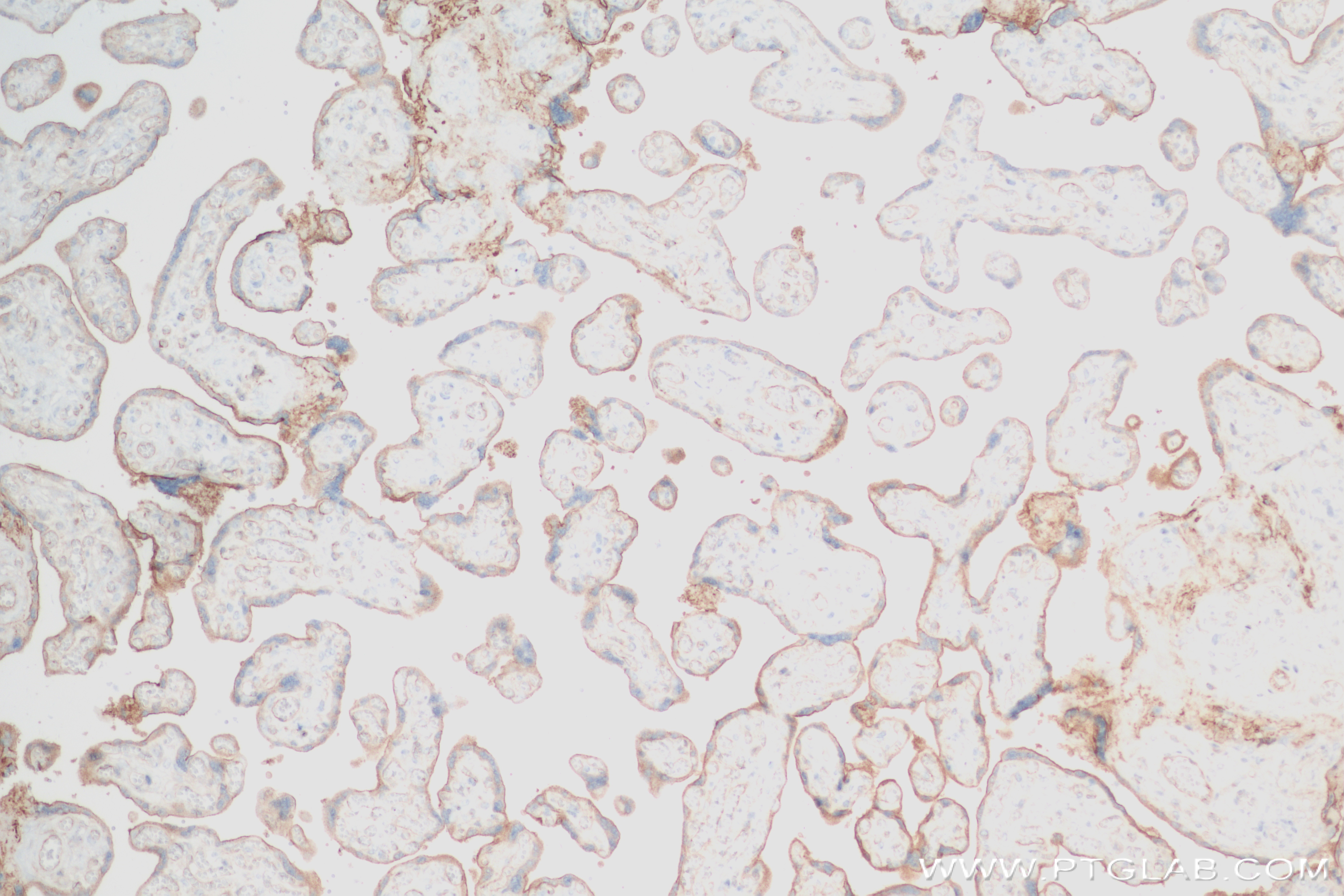 IHC staining of human placenta using 82993-6-RR (same clone as 82993-6-PBS)