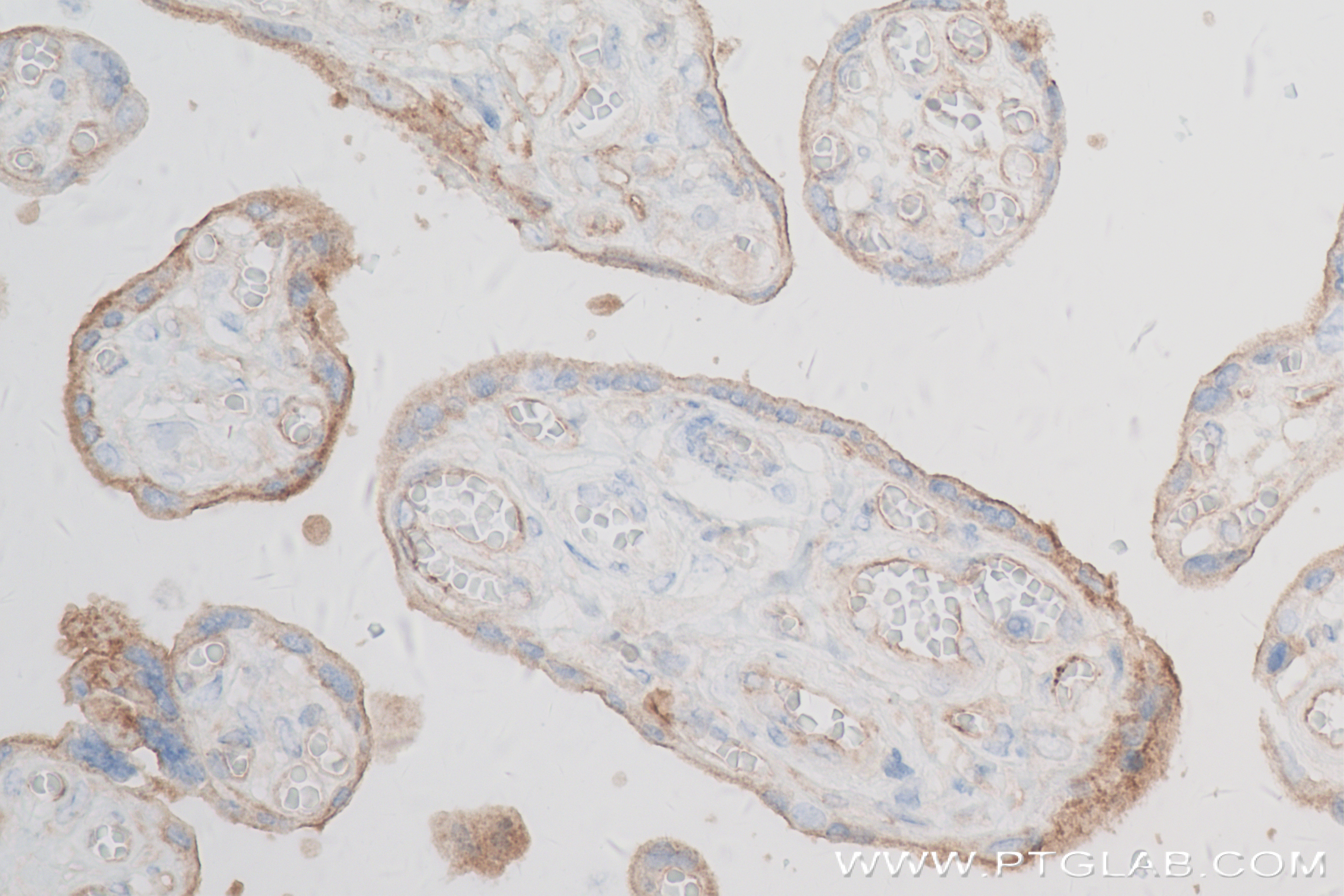 IHC staining of human placenta using 82993-6-RR (same clone as 82993-6-PBS)