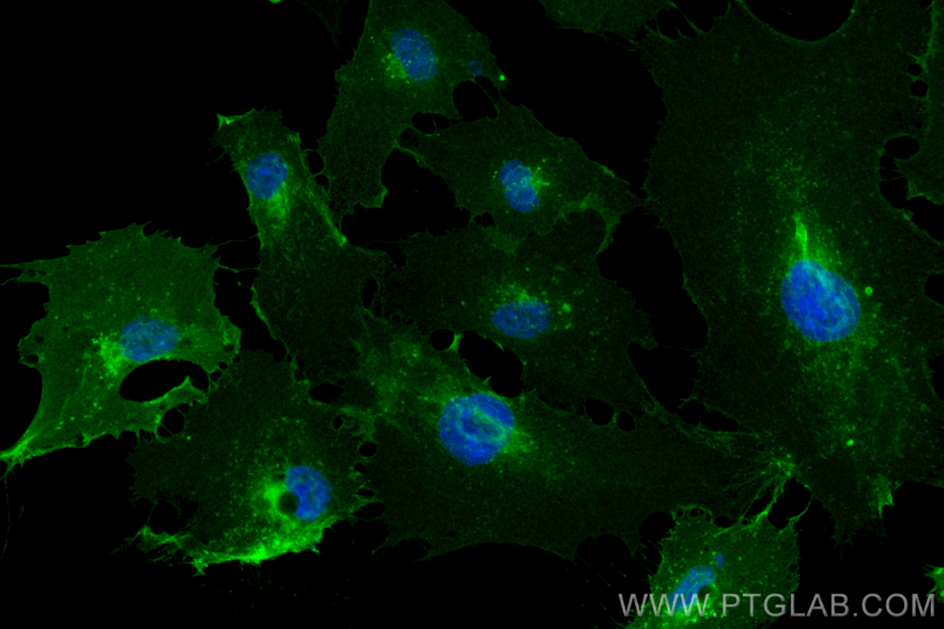 IF Staining of HUVEC using CL488-82993-5