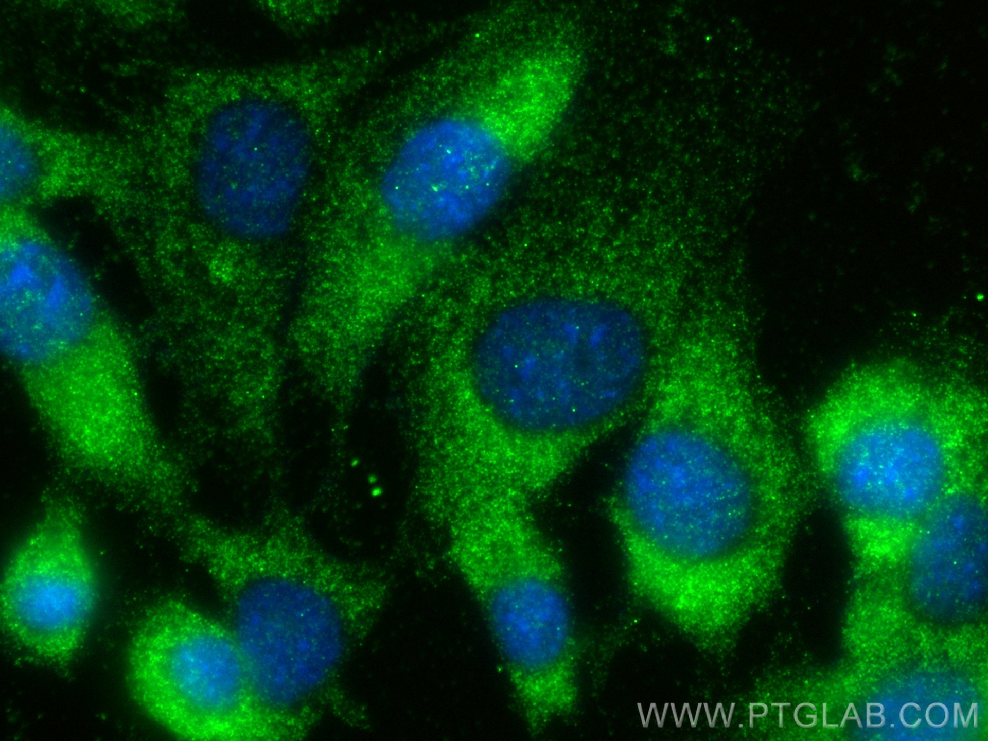 IF Staining of NIH/3T3 using 27871-1-AP