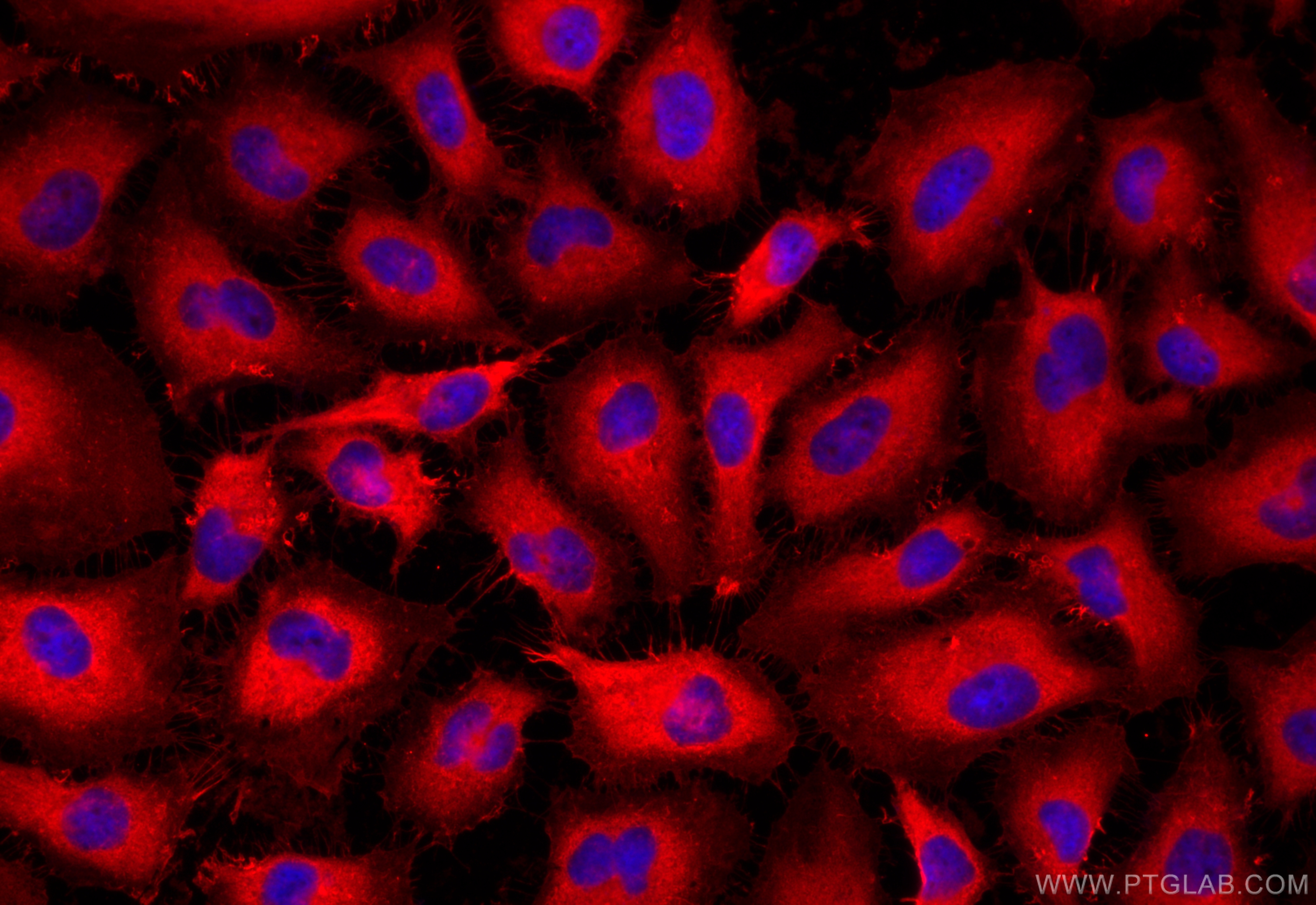 IF Staining of HeLa using 26056-1-AP