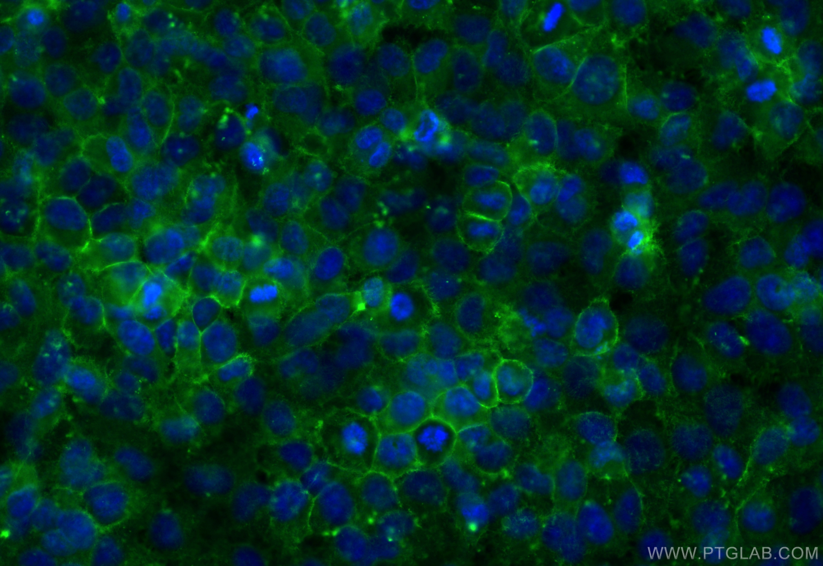 IF Staining of HeLa using CL488-26056