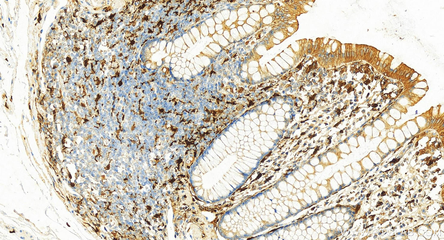 IHC staining of human normal colon using 17223-1-AP