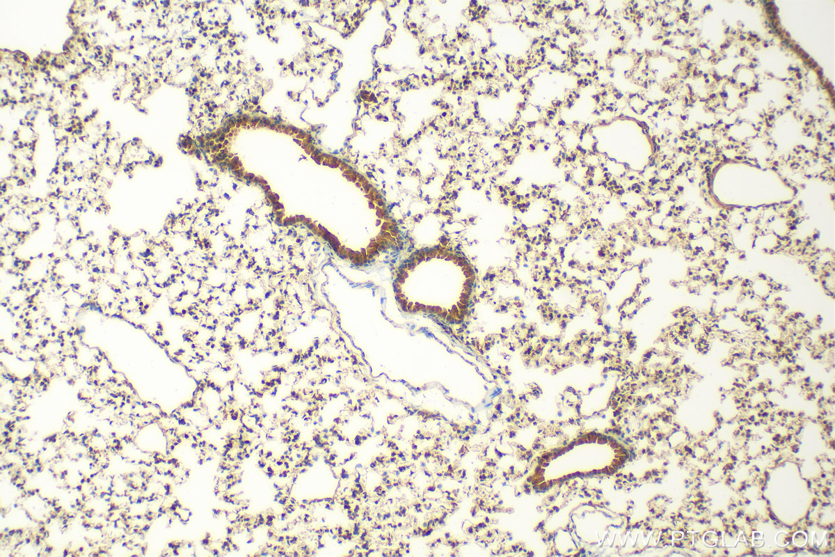 IHC staining of mouse lung using 25306-1-AP