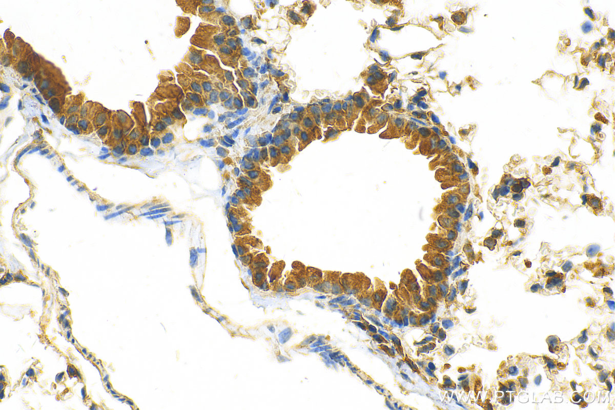 IHC staining of mouse lung using 25306-1-AP