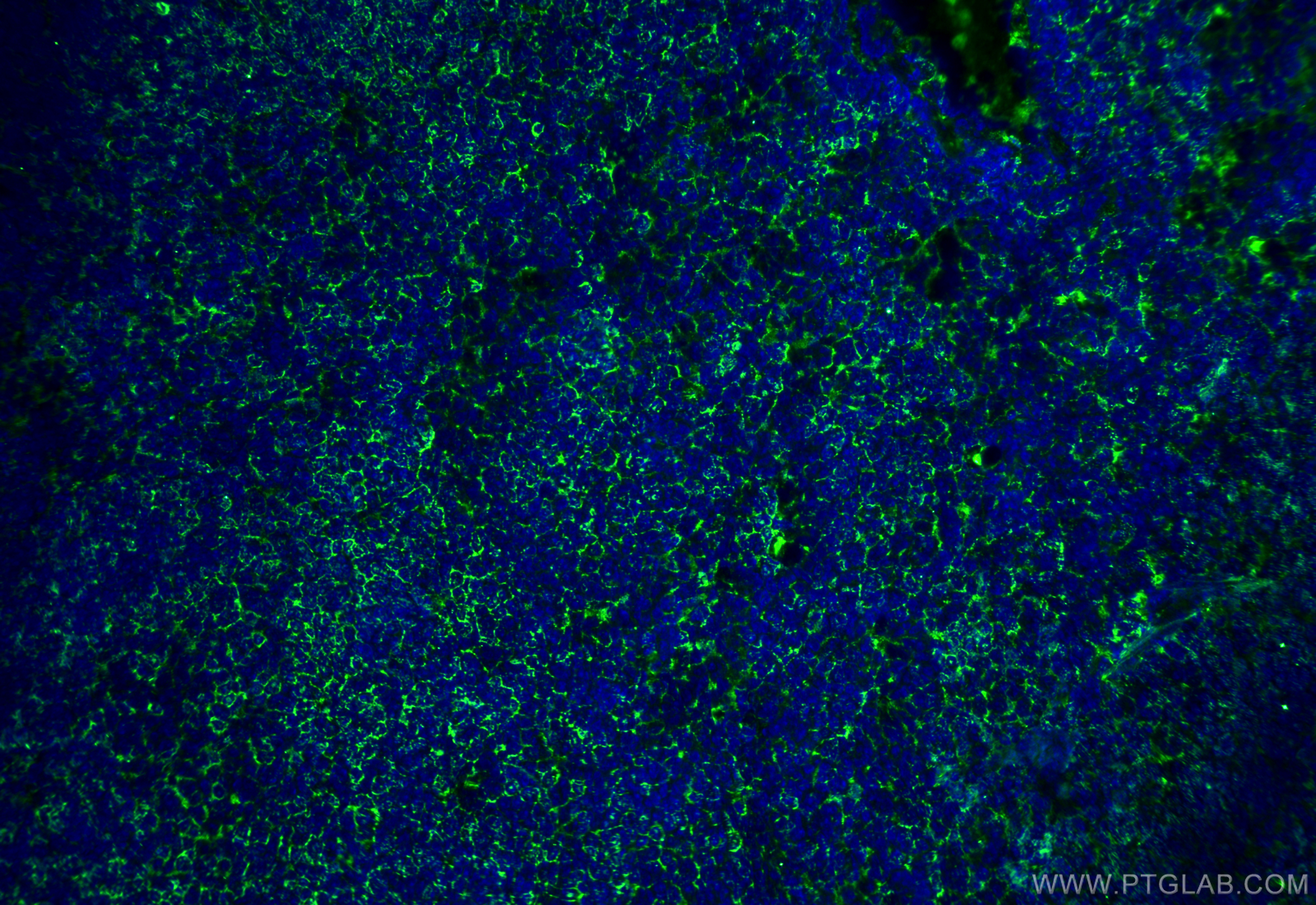 IF Staining of mouse spleen using 81668-1-RR