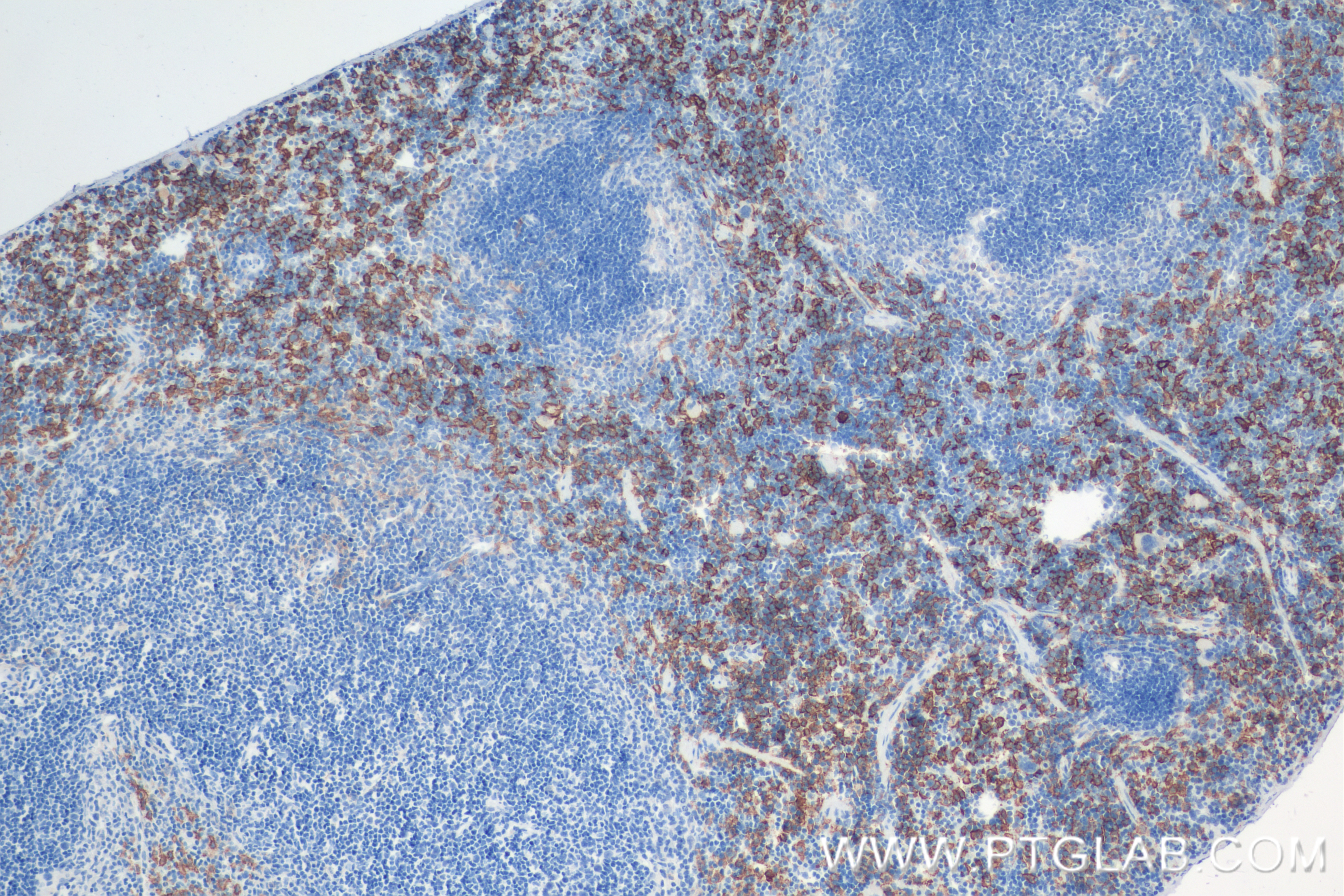 IHC staining of mouse spleen using 81668-1-RR (same clone as 81668-1-PBS)