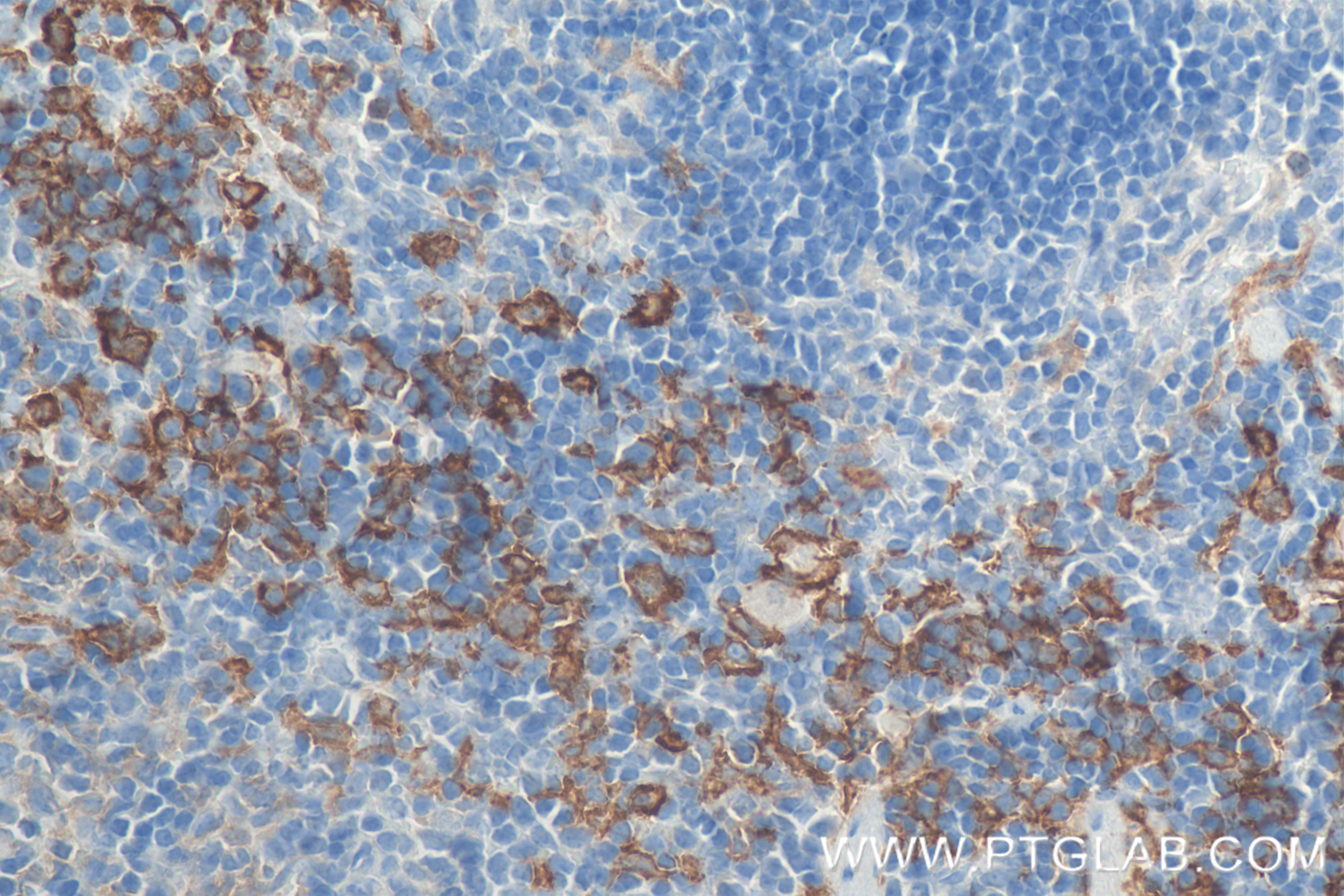 IHC staining of mouse spleen using 81668-1-RR (same clone as 81668-1-PBS)