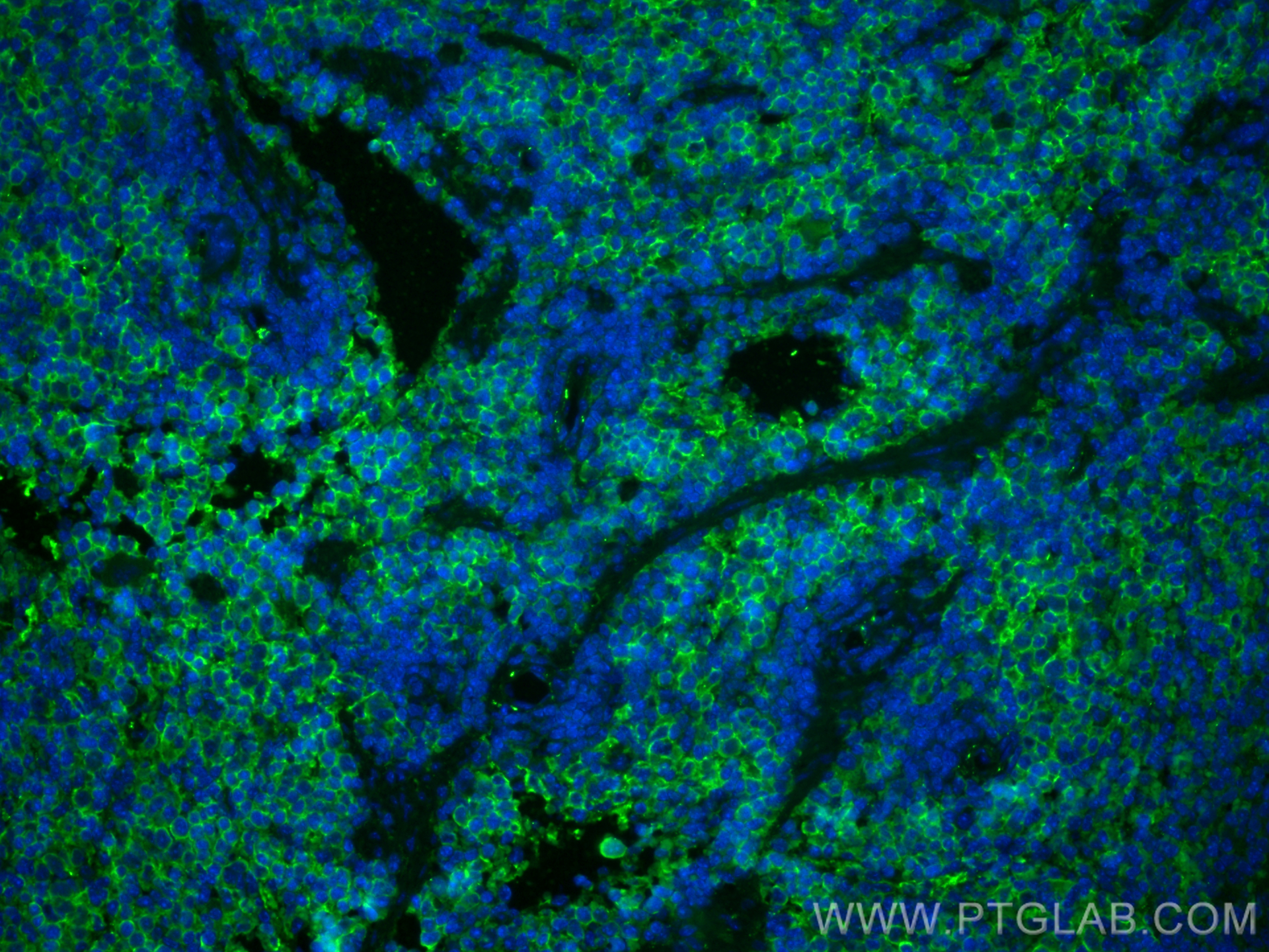 IF Staining of mouse spleen using CL488-28463