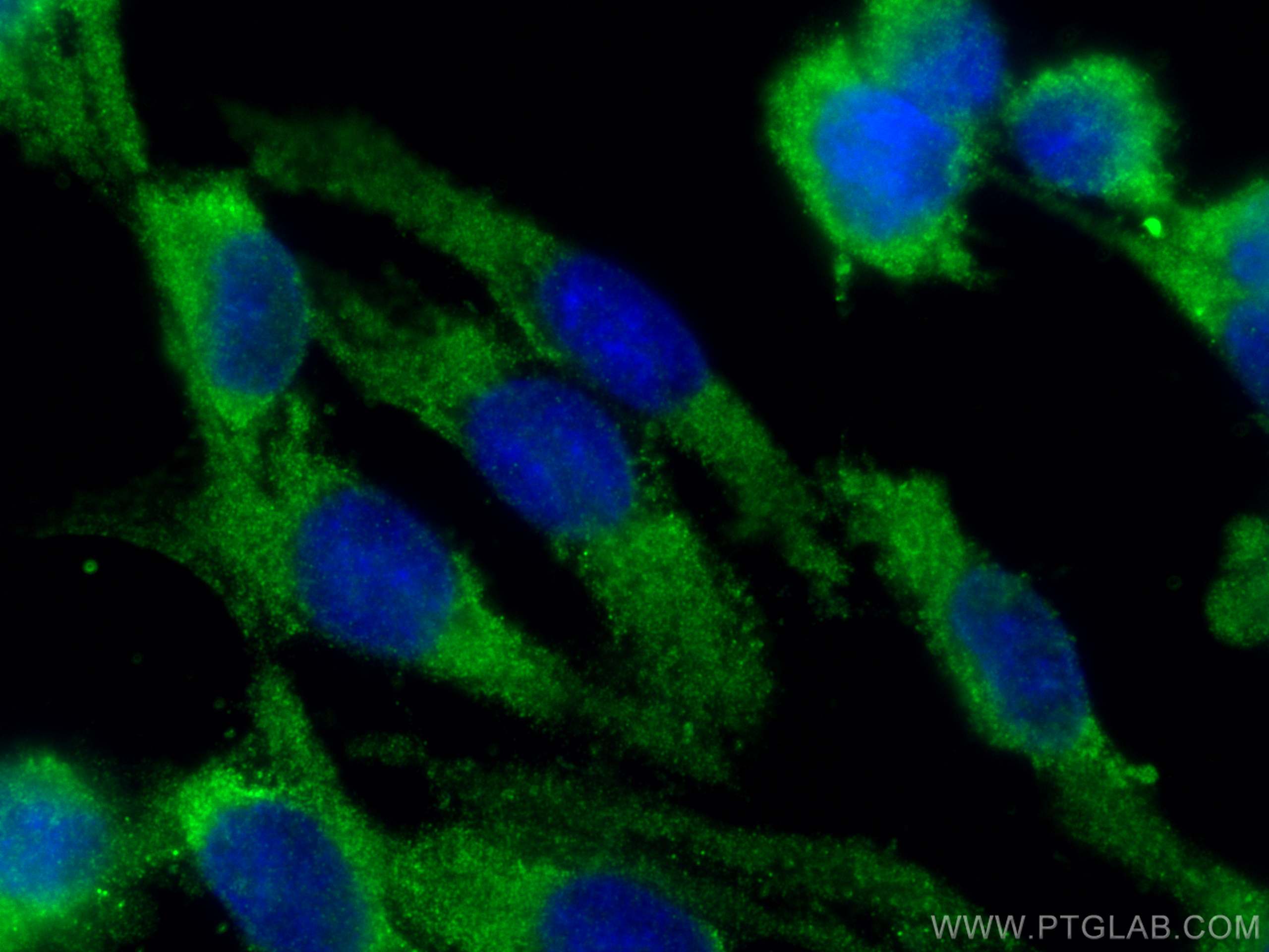 IF Staining of HUVEC using 23058-1-AP