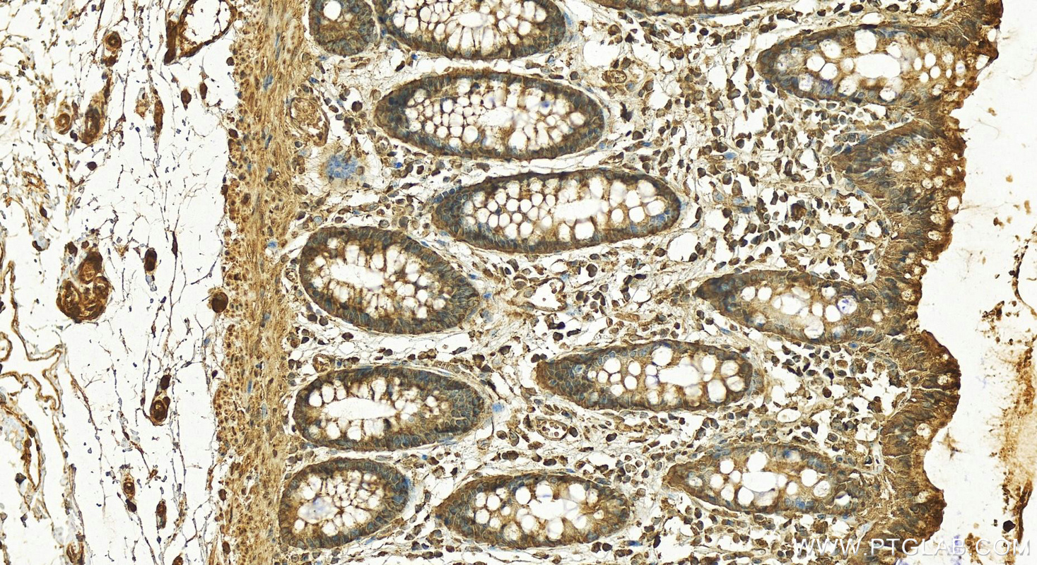 IHC staining of human colon using 15872-1-AP