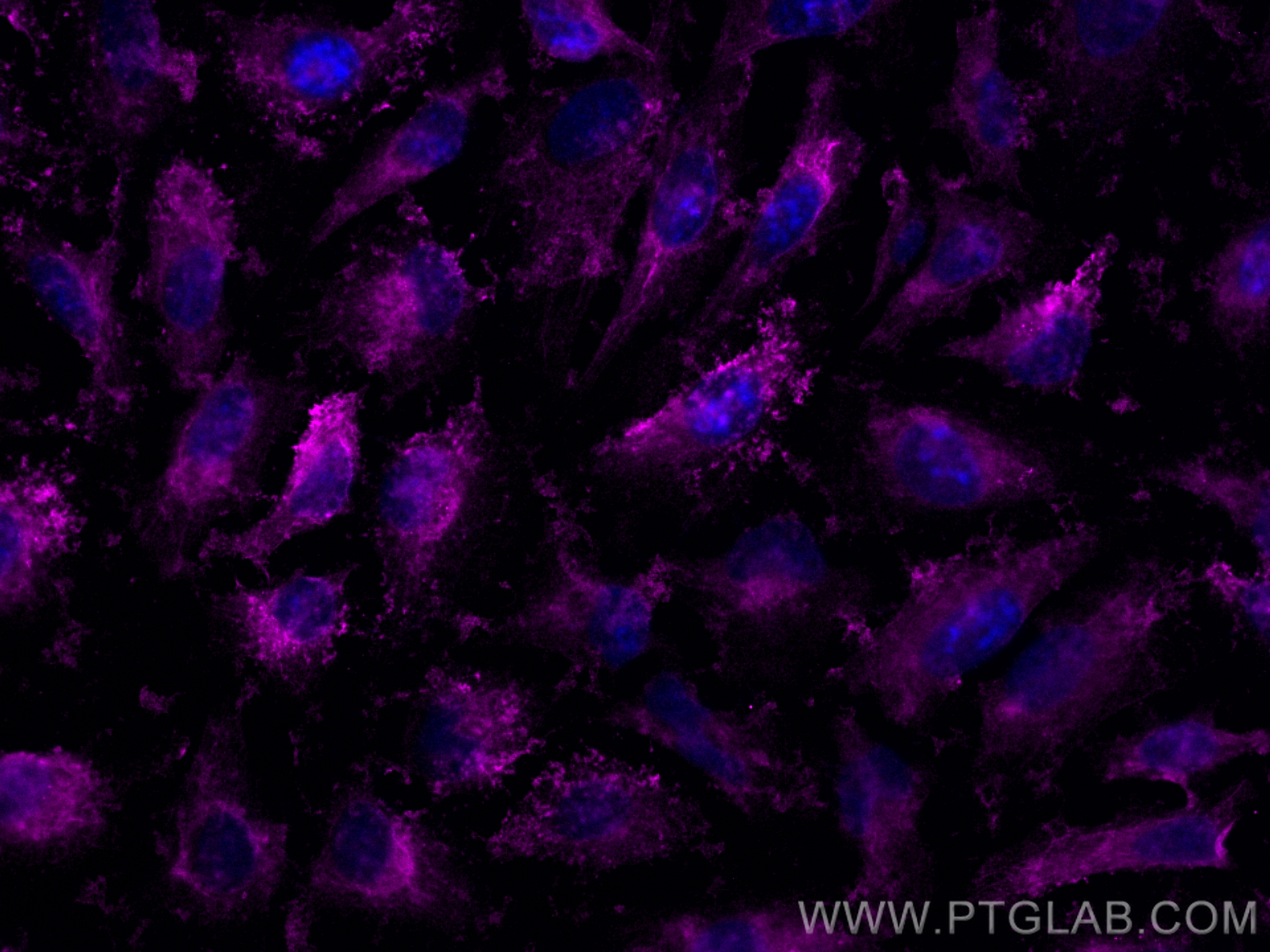 IF Staining of HeLa using CL647-12348