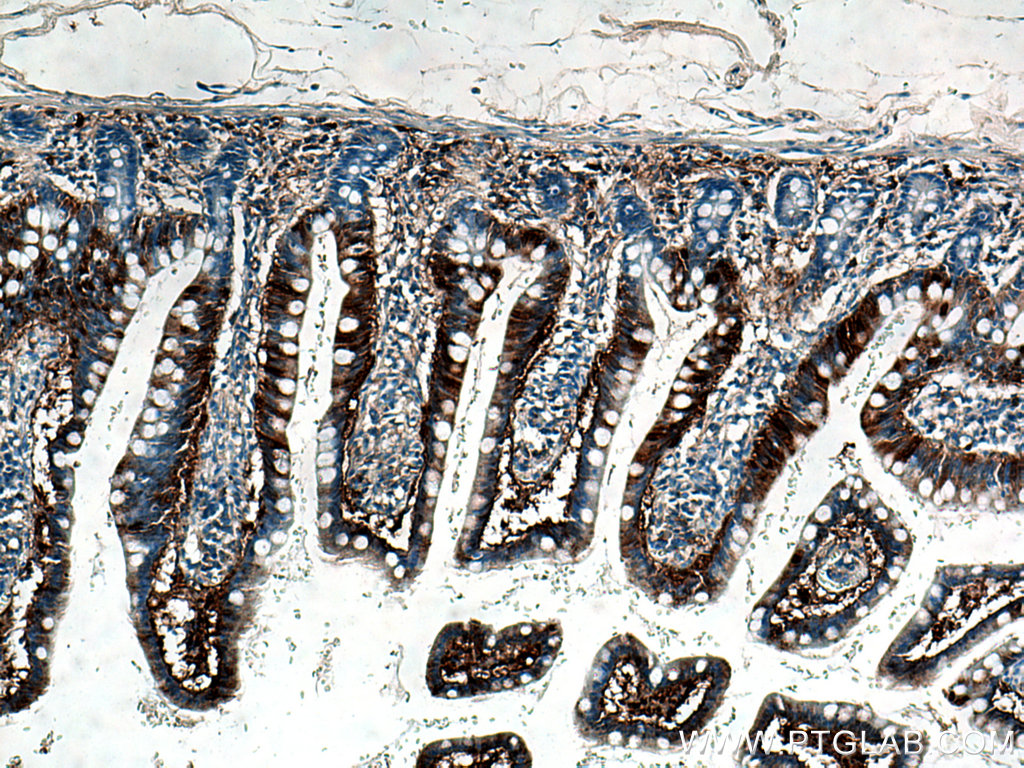 IHC staining of human small intestine using 13781-1-AP