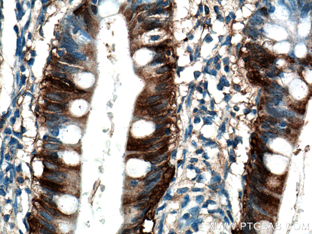 IHC staining of human small intestine using 13781-1-AP