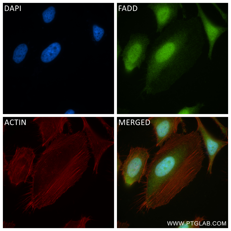 IF Staining of HeLa using 84619-5-RR (same clone as 84619-5-PBS)