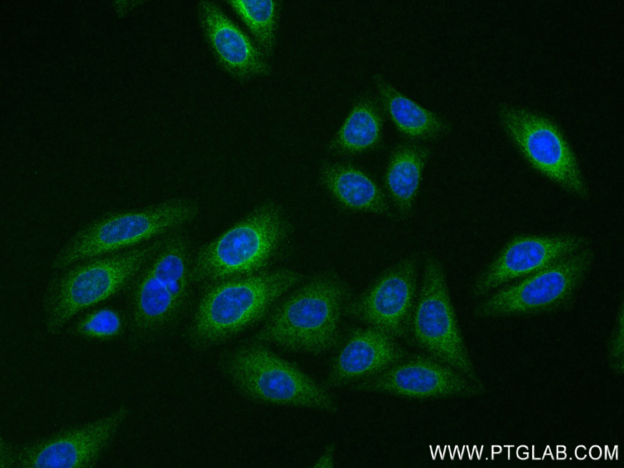 IF Staining of HepG2 using 84527-5-RR