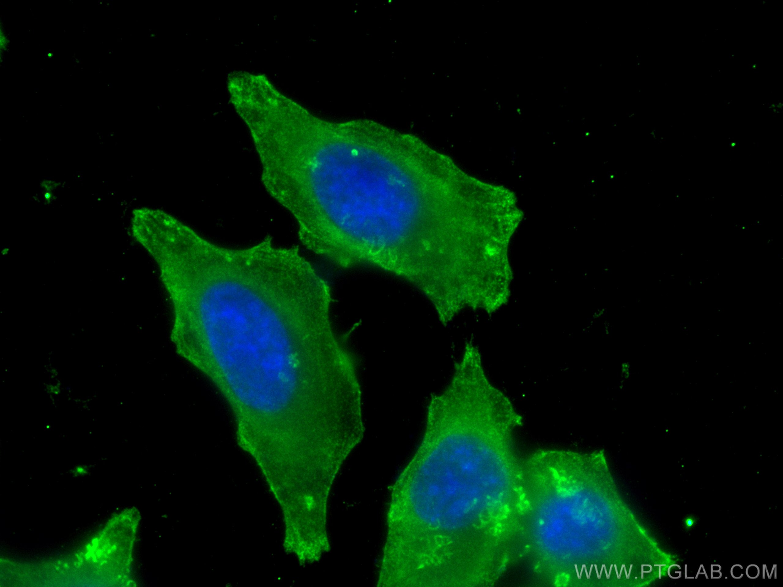 IF Staining of HepG2 using 67986-1-Ig (same clone as 67986-1-PBS)