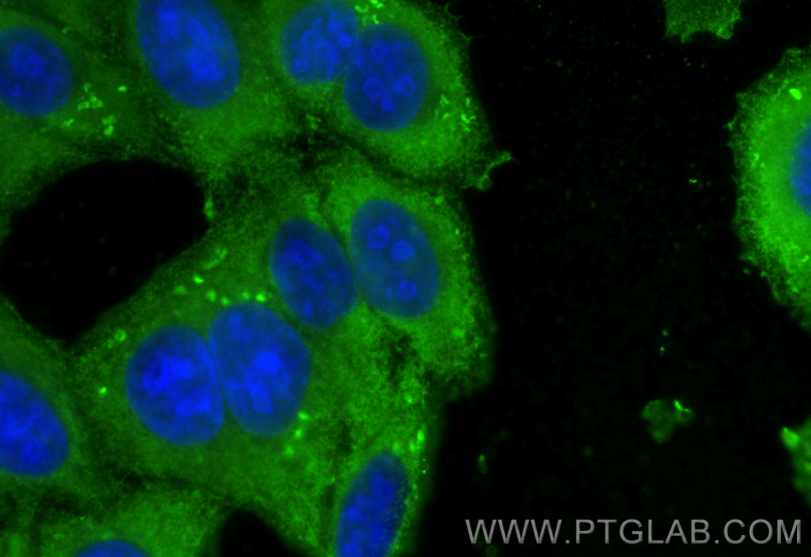 IF Staining of HepG2 using 67986-1-Ig (same clone as 67986-1-PBS)