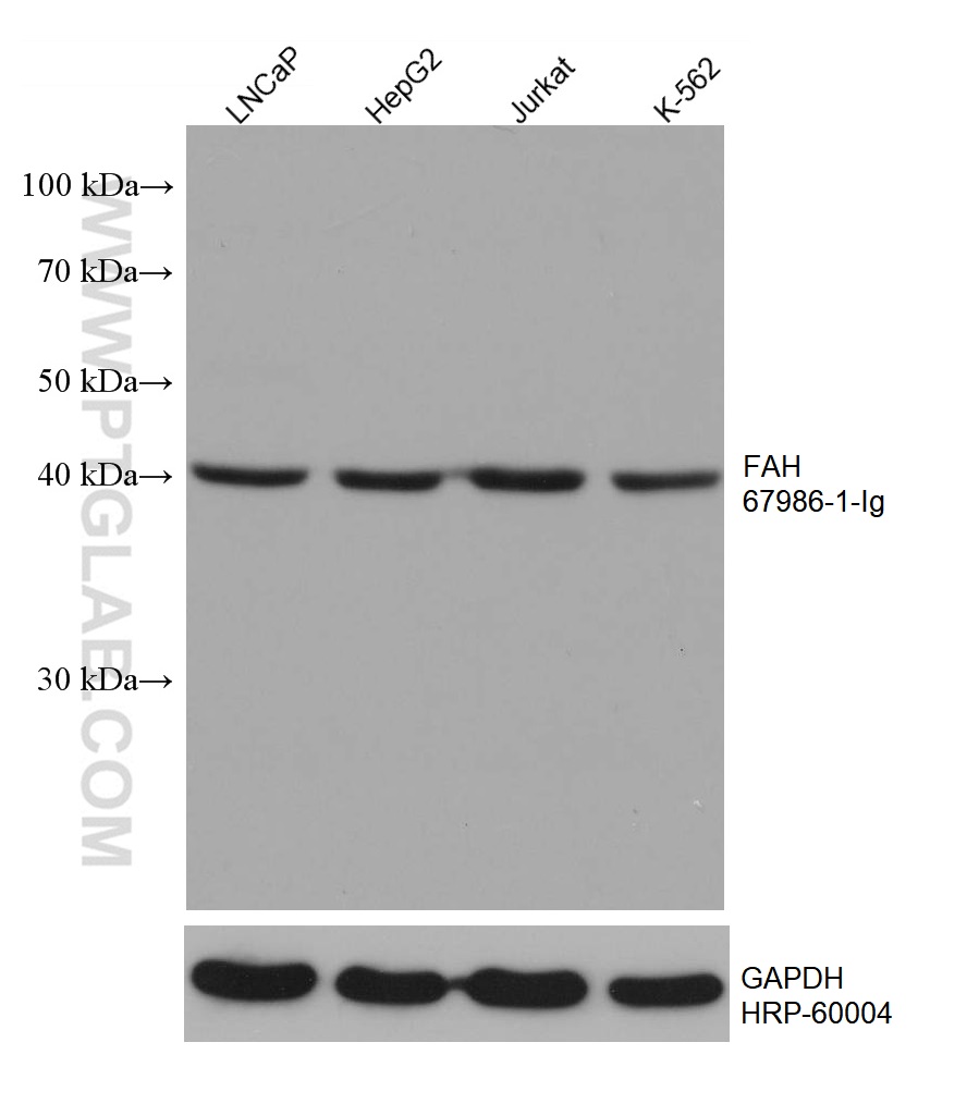 WB analysis using 67986-1-Ig