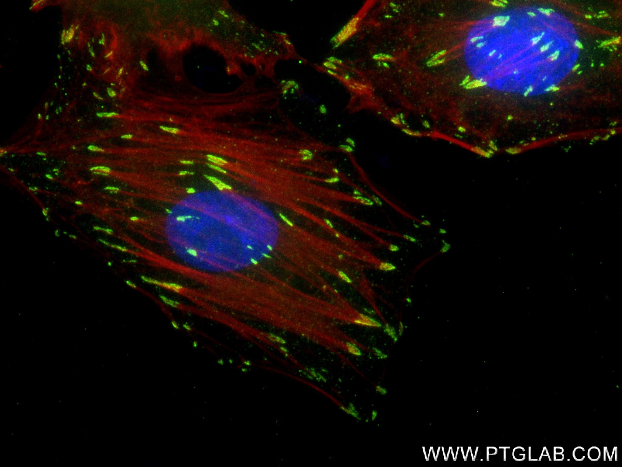 IF Staining of A549 using 83933-1-RR (same clone as 83933-1-PBS)