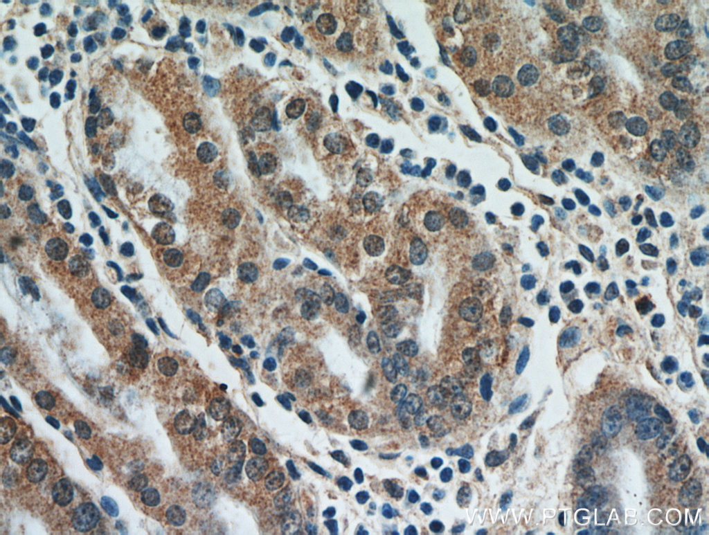 IHC staining of human stomach using 21113-1-AP